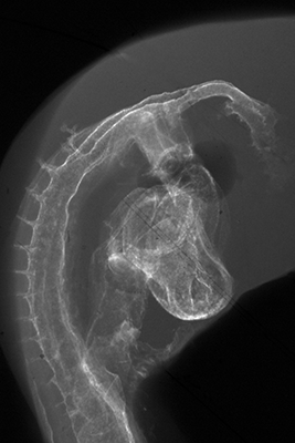 stage 16 chick embryo x-ray