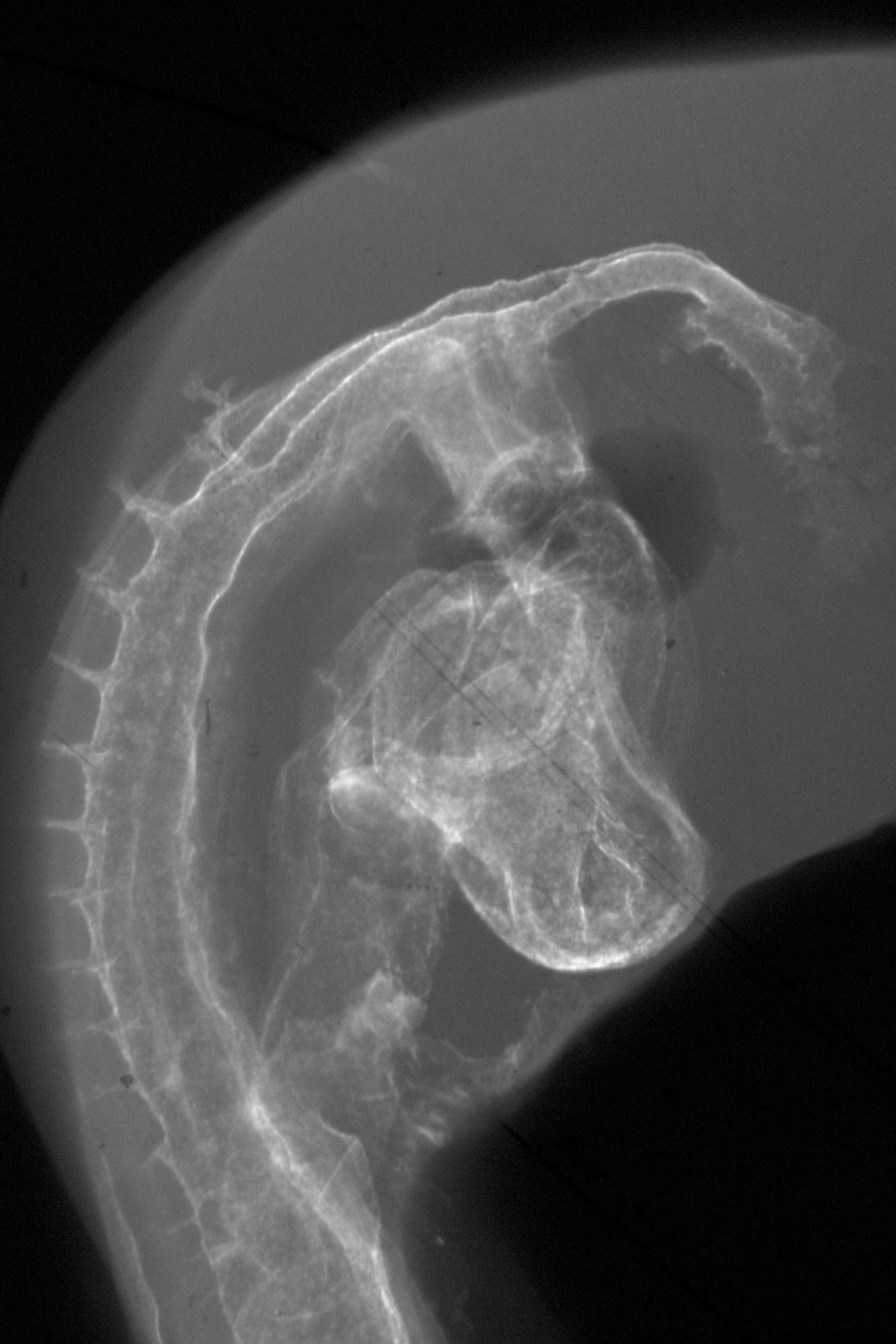 stage 16 chick embryo x-ray