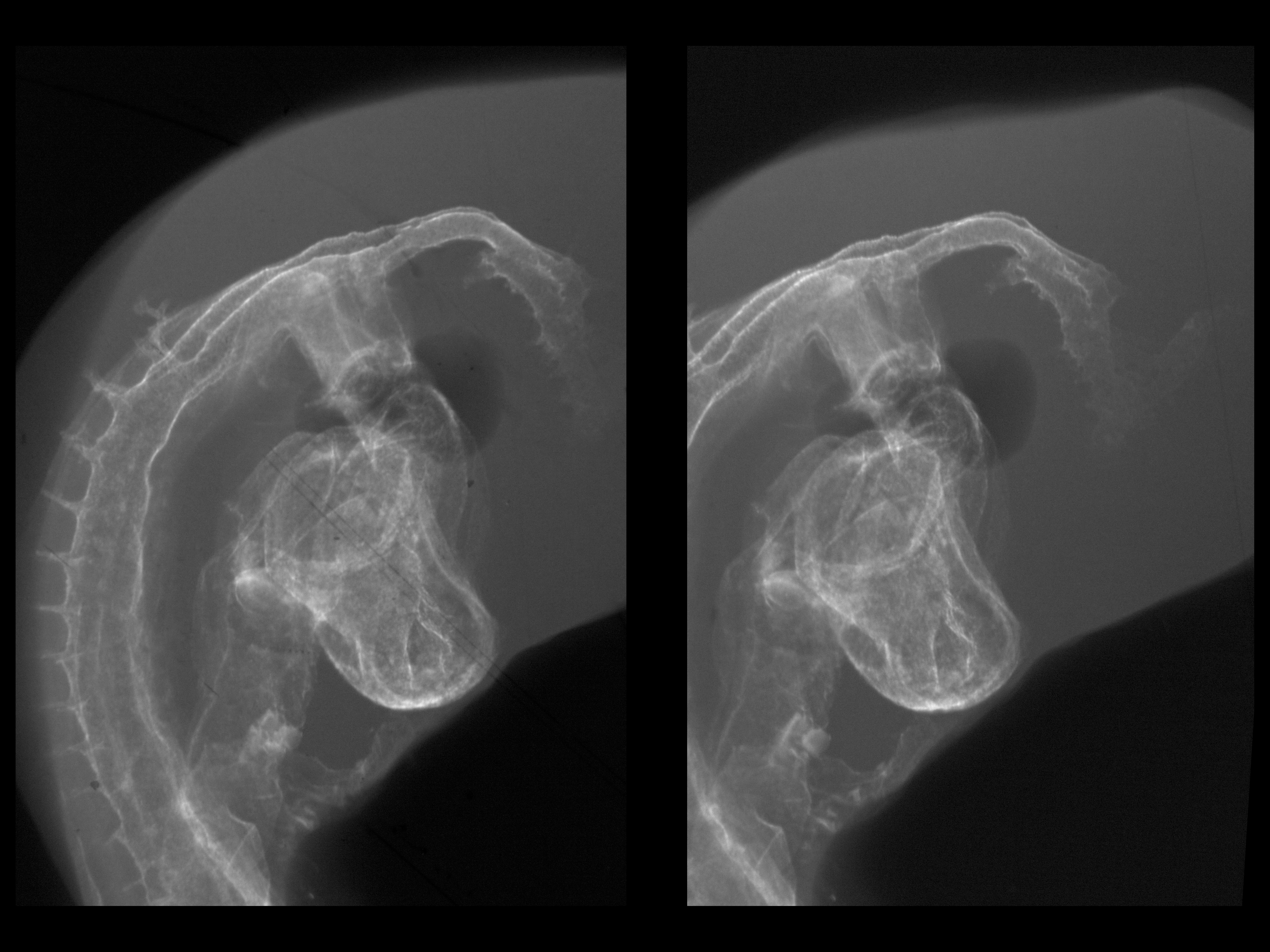 stage 16 chick embryo x-ray