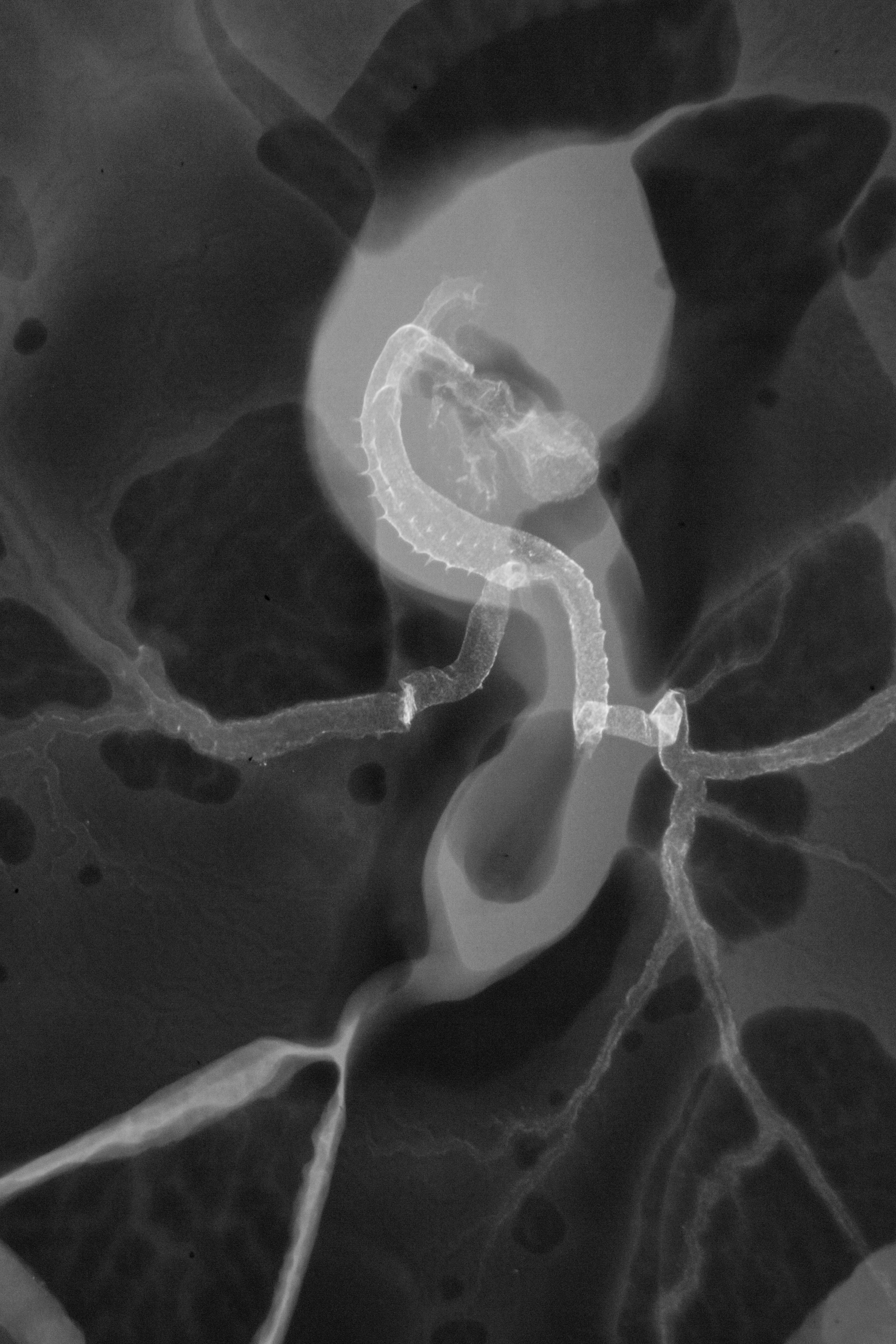 stage 16 chick embryo x-ray