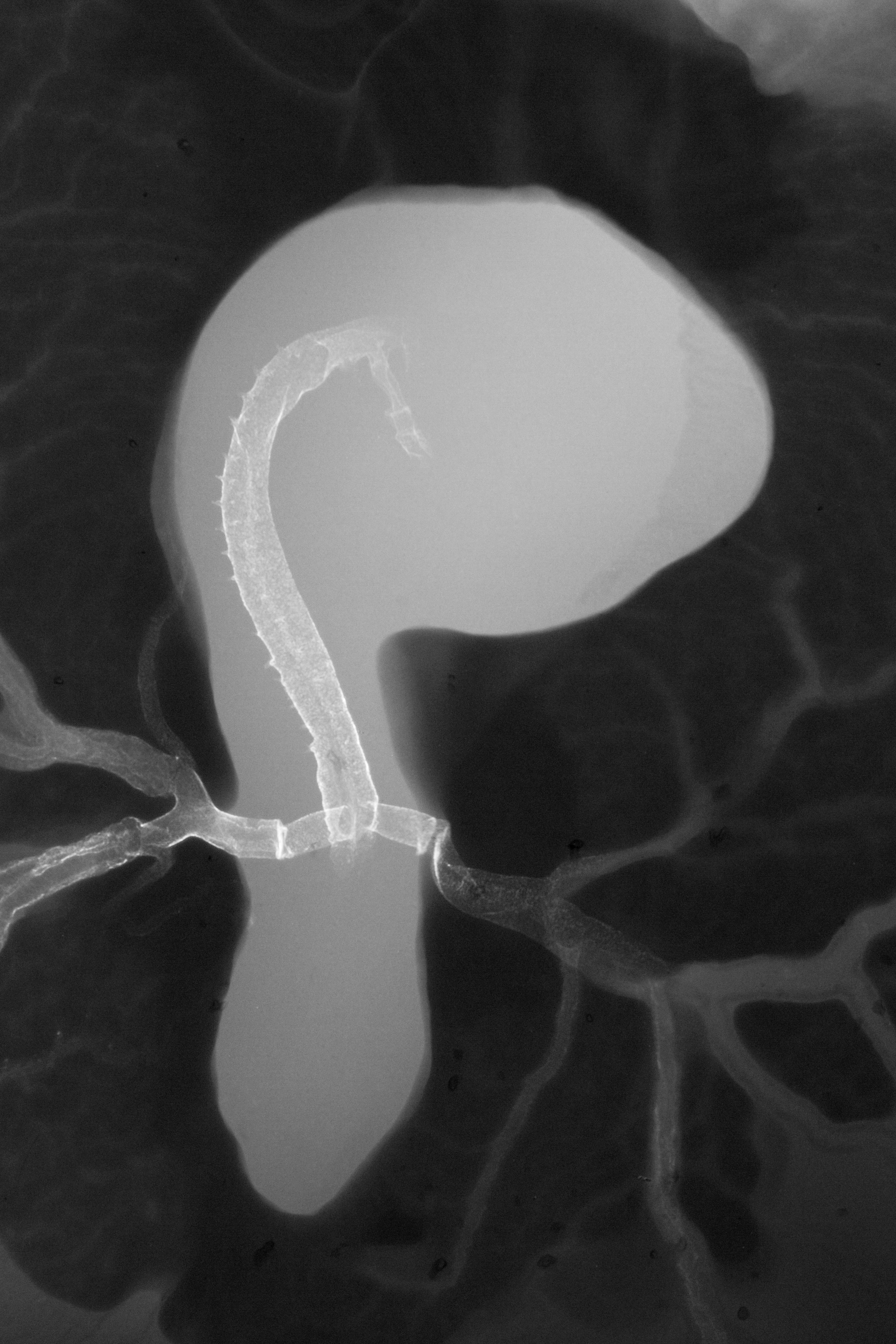 stage 16 chick embryo x-ray
