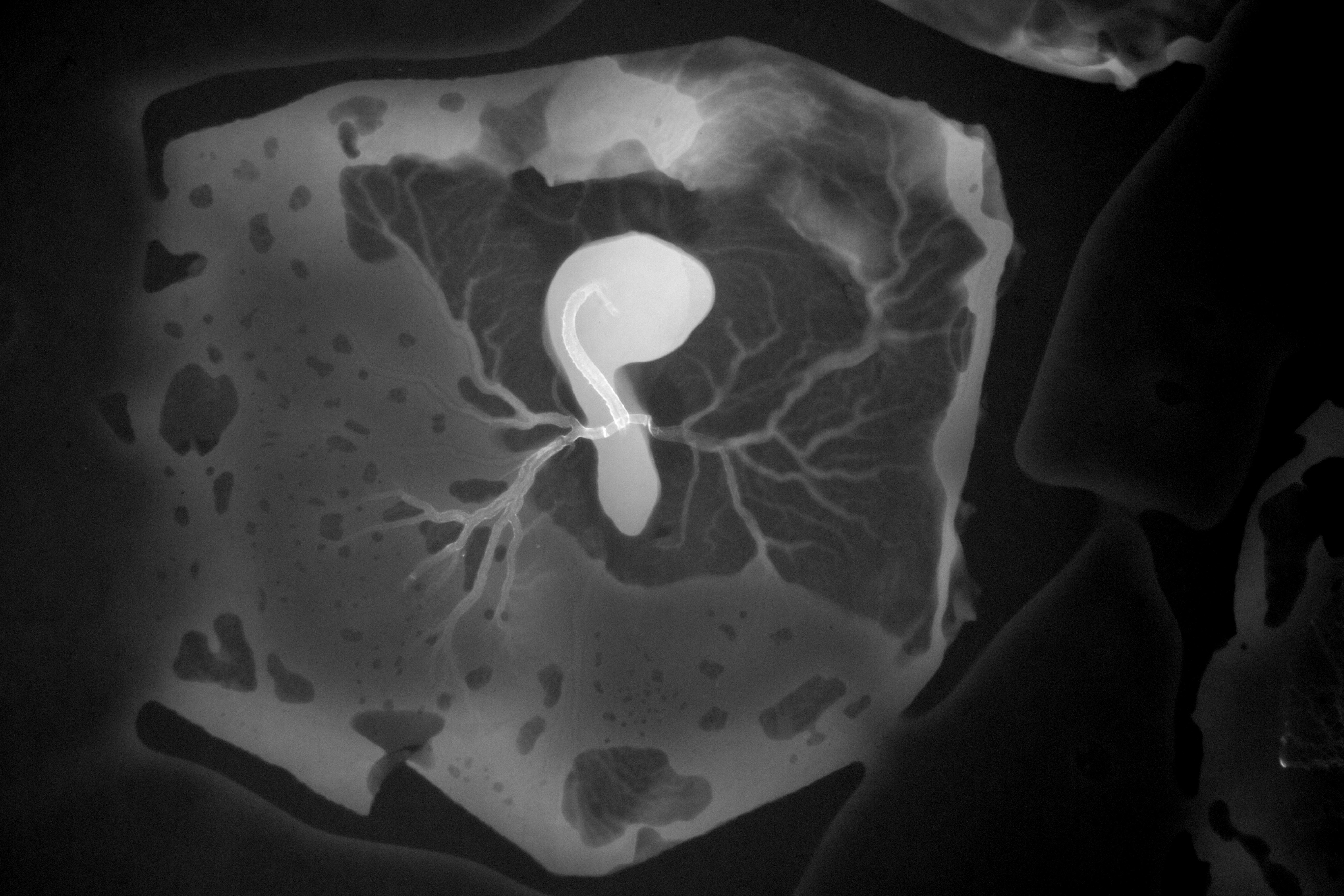 stage 16 chick embryo x-ray