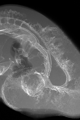 stage 17 chick embryo x-ray