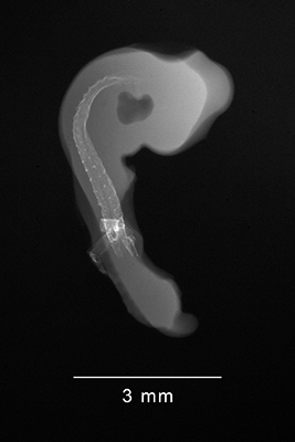 stage 18 chick embryo x-ray