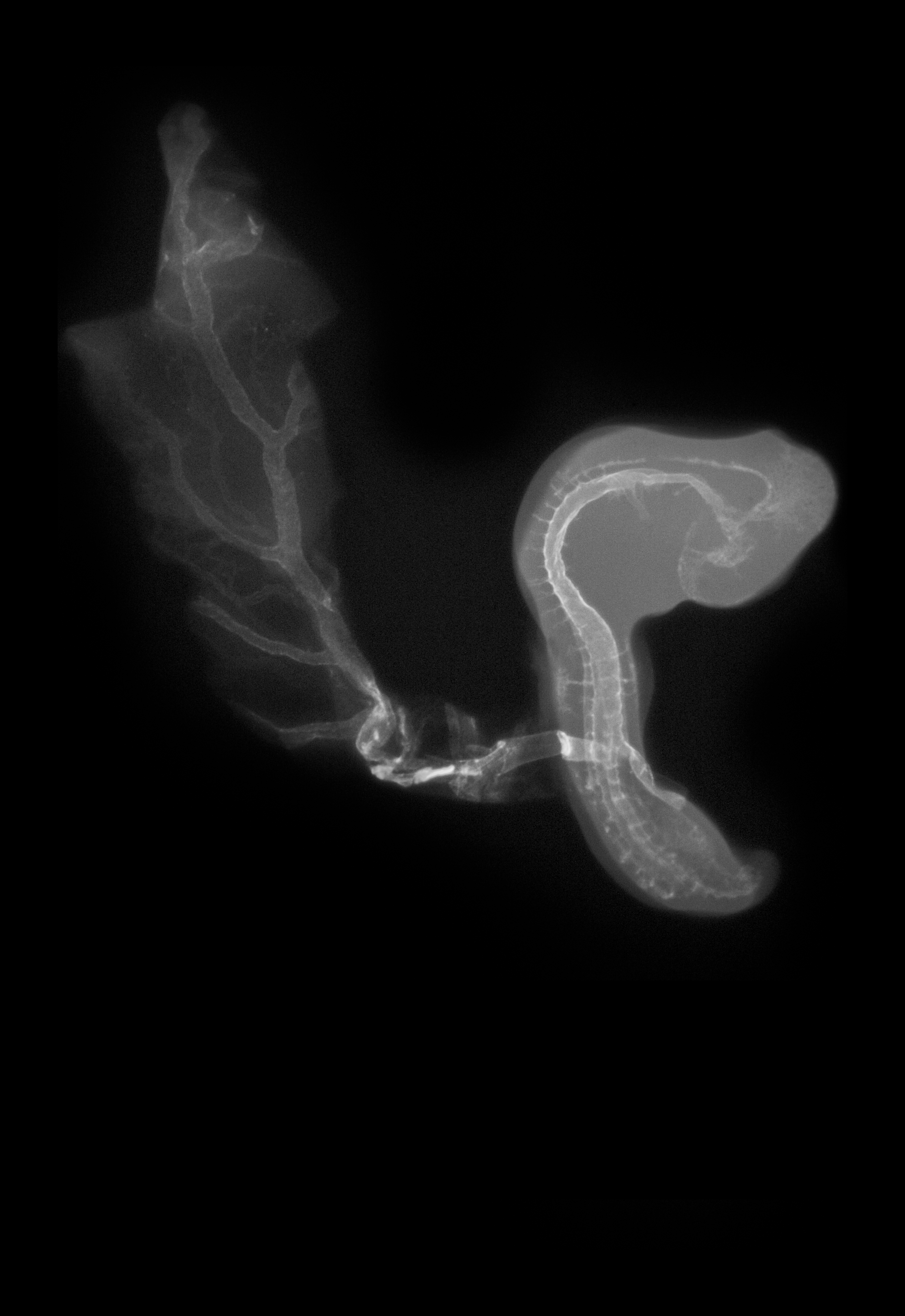 stage 18 chick embryo x-ray