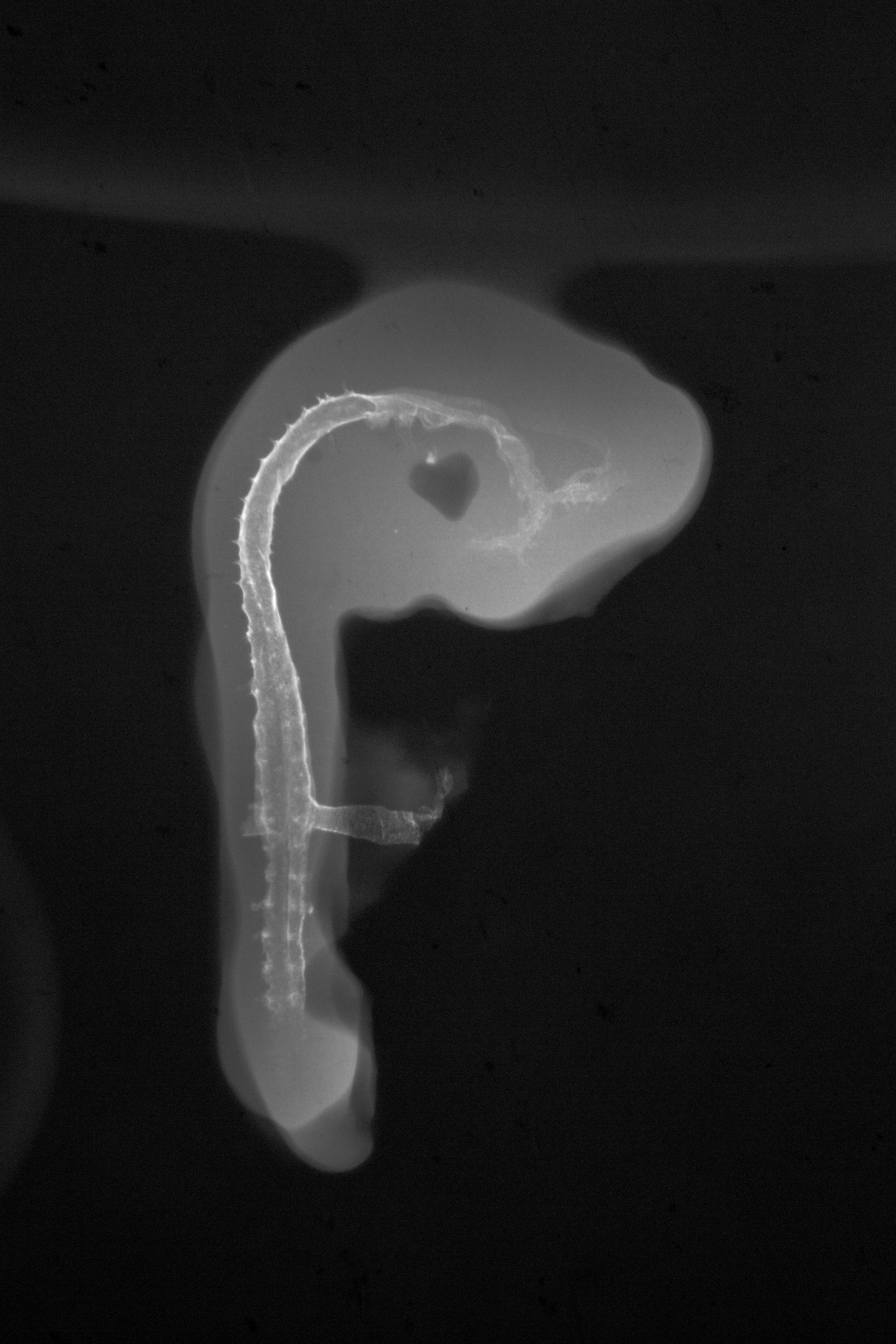 stage 18 chick embryo x-ray