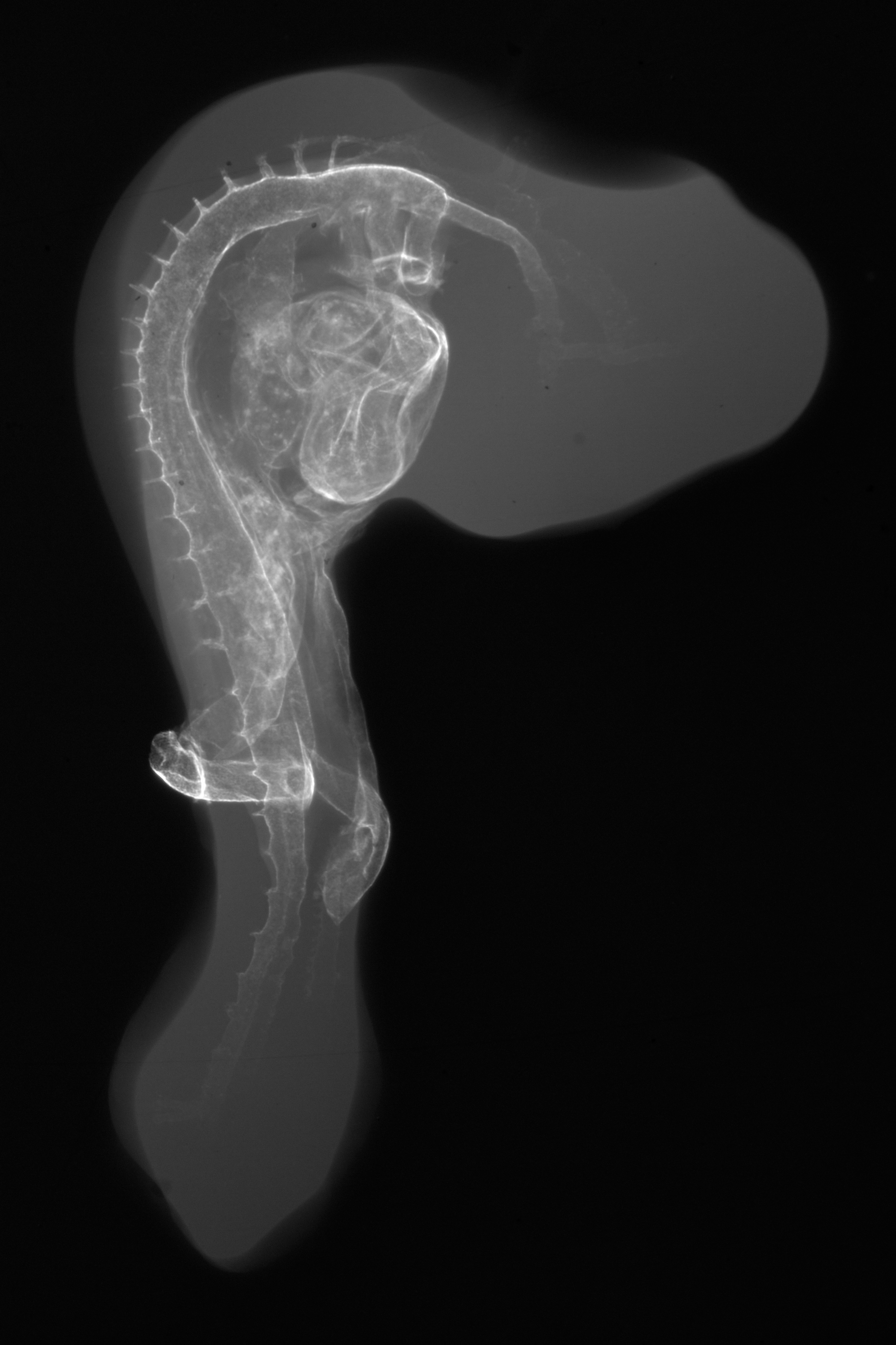 stage 18 chick embryo x-ray