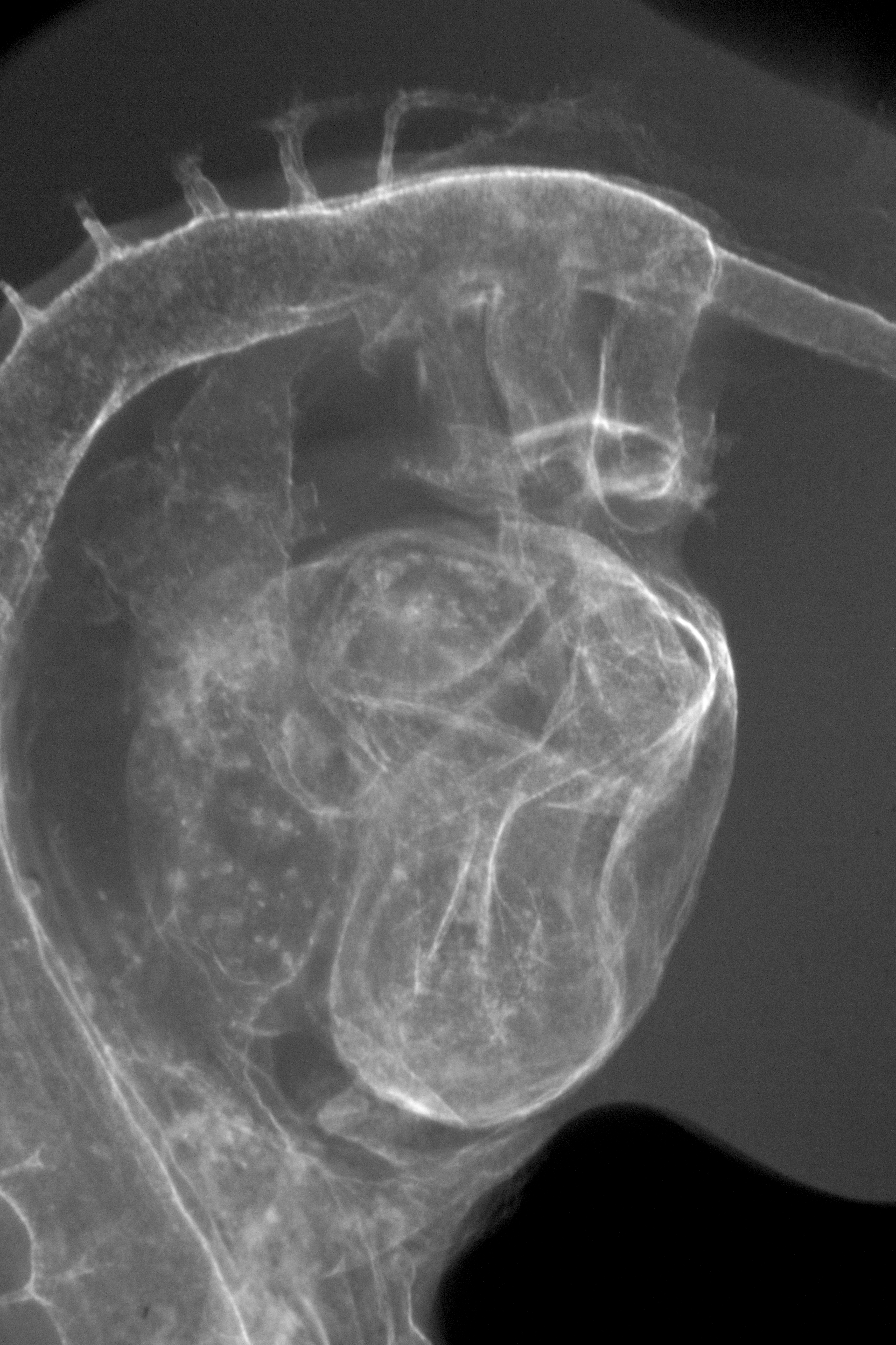 stage 18 chick embryo x-ray