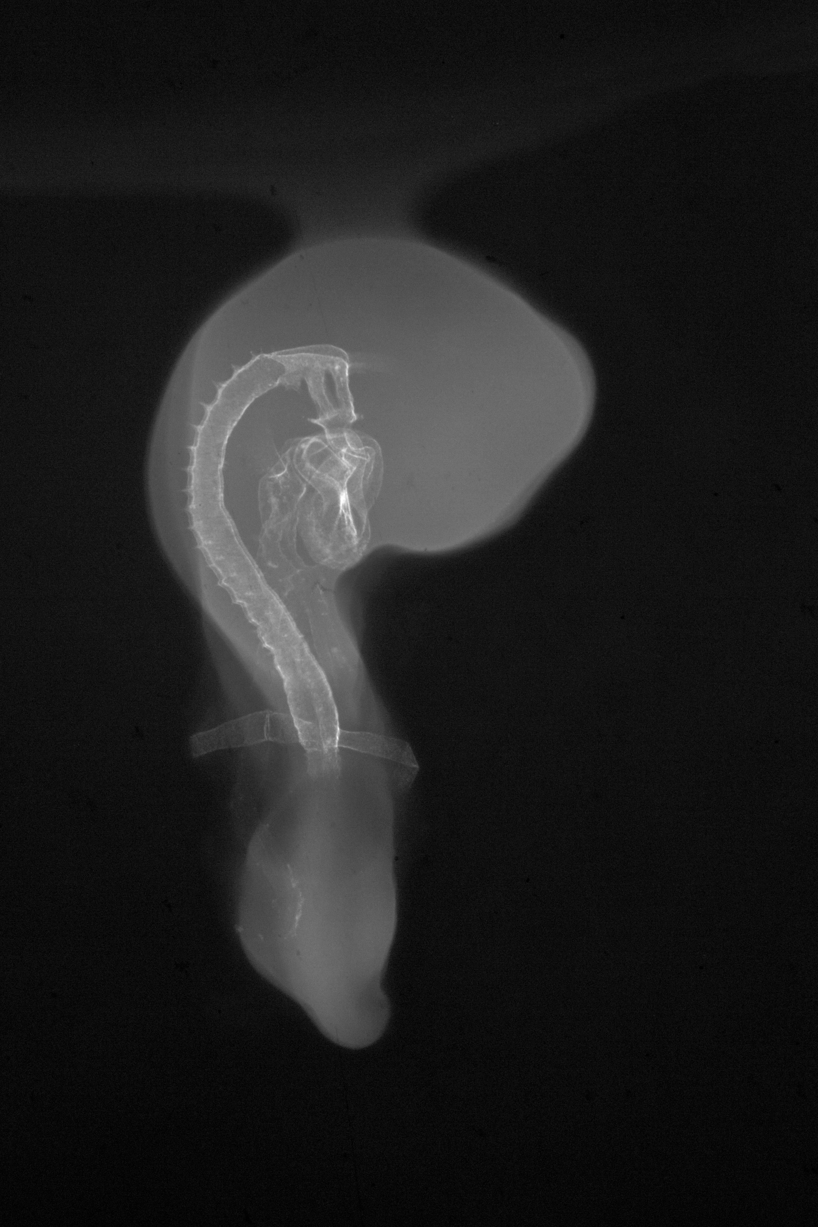 stage 18 chick embryo x-ray