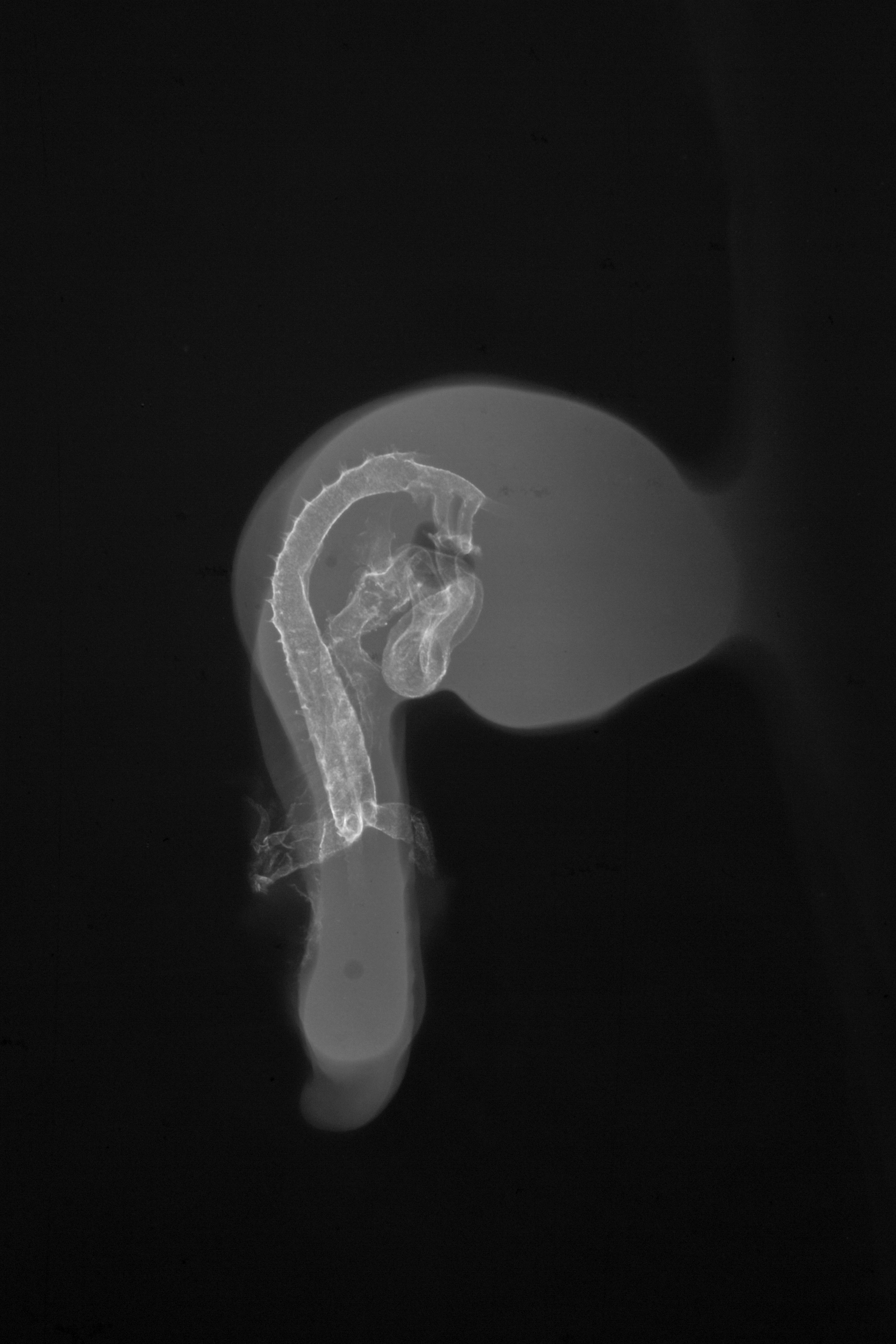 stage 18 chick embryo x-ray