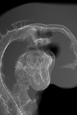 stage 19 chick embryo x-ray