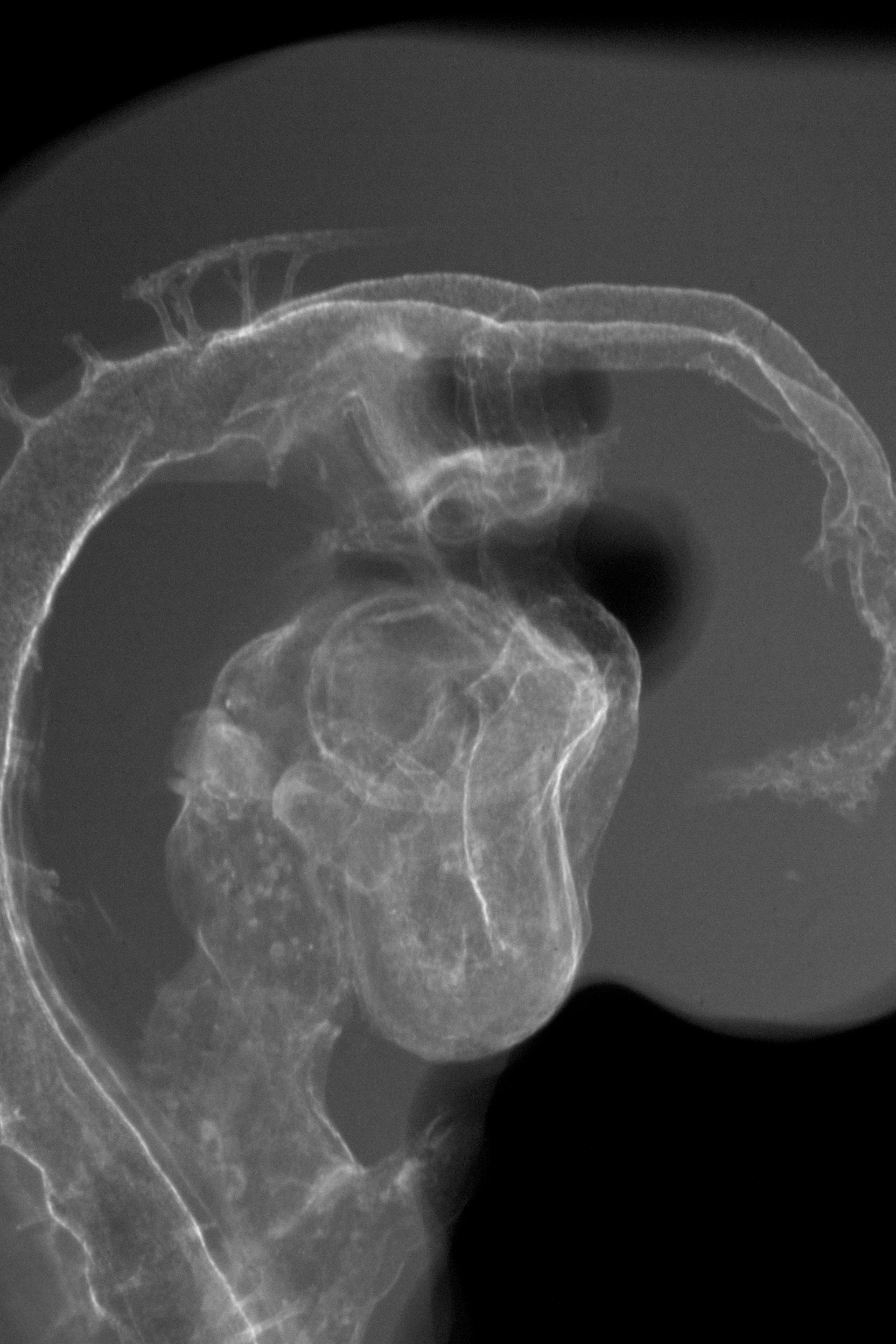 stage 19 chick embryo x-ray