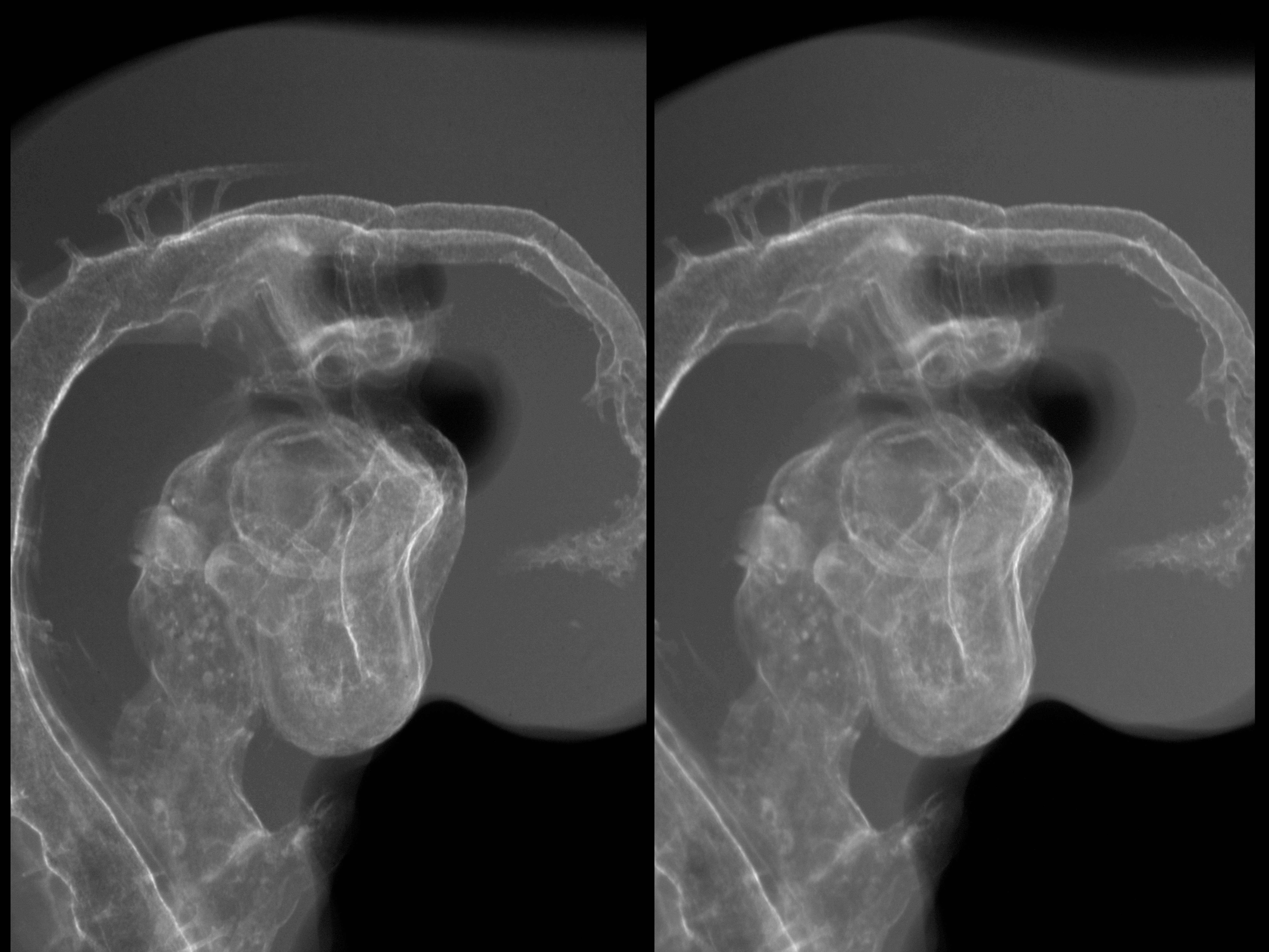 stage 19 chick embryo x-ray