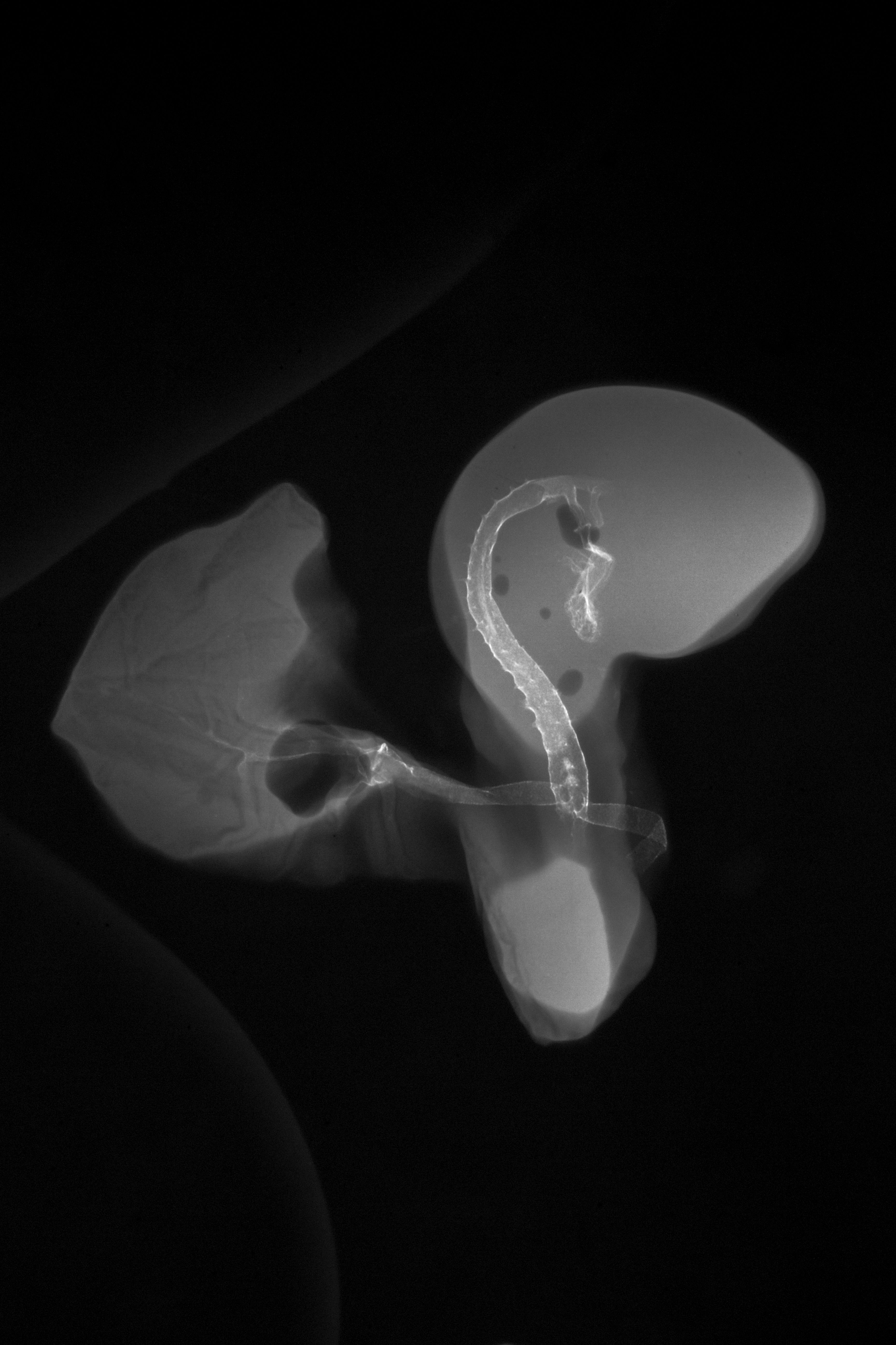 stage 19 chick embryo x-ray
