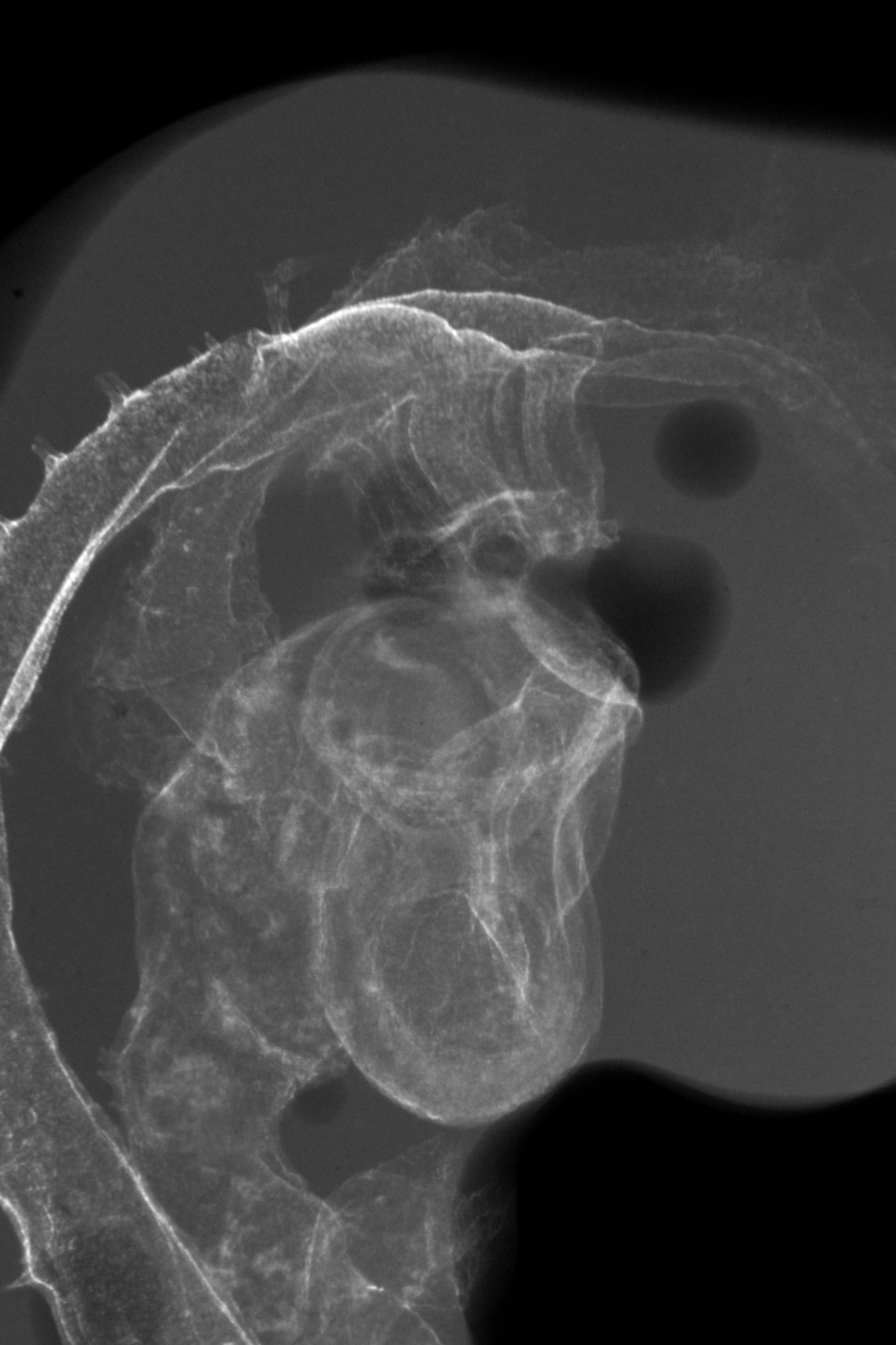 stage 20 chick embryo x-ray