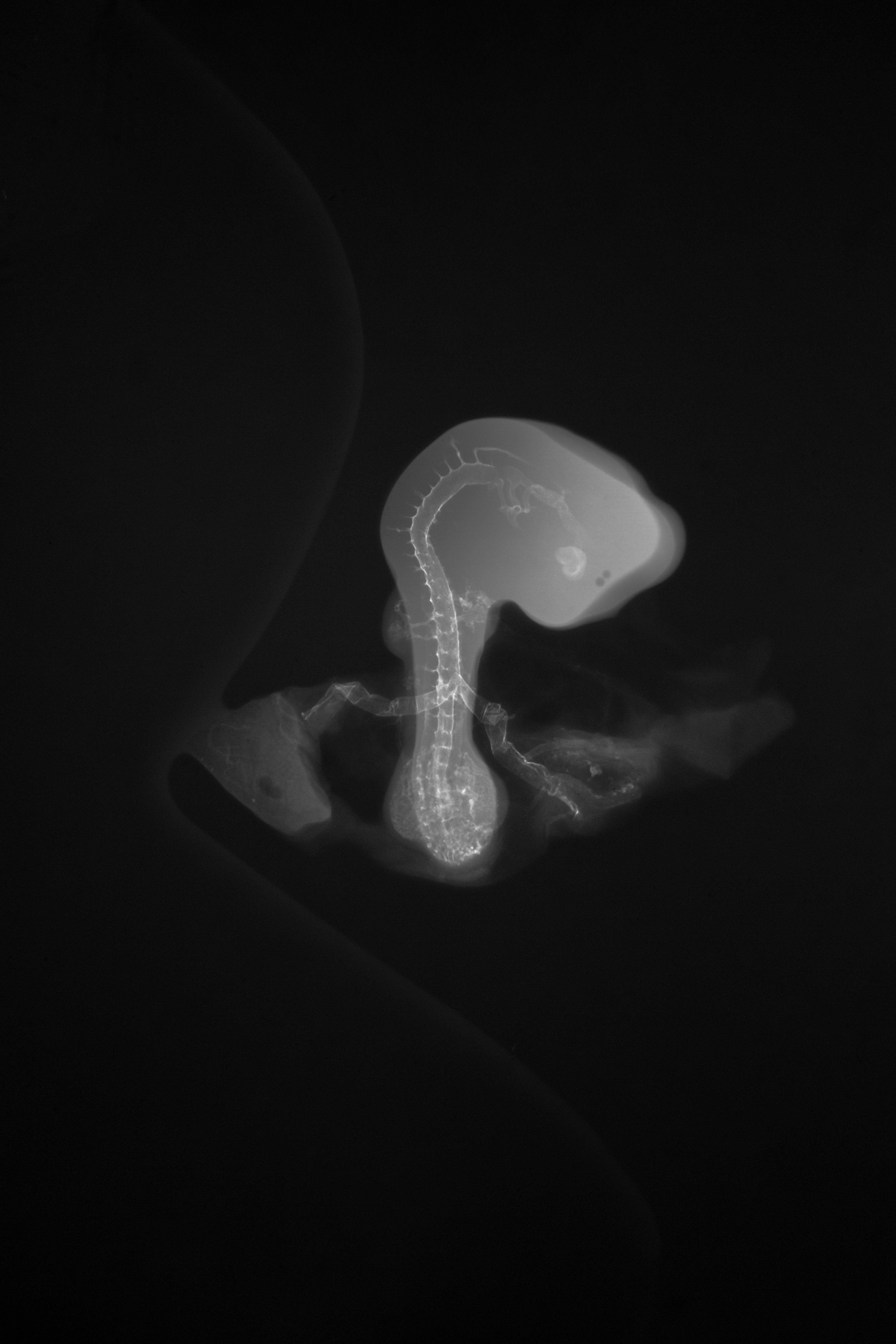 stage 20 chick embryo x-ray
