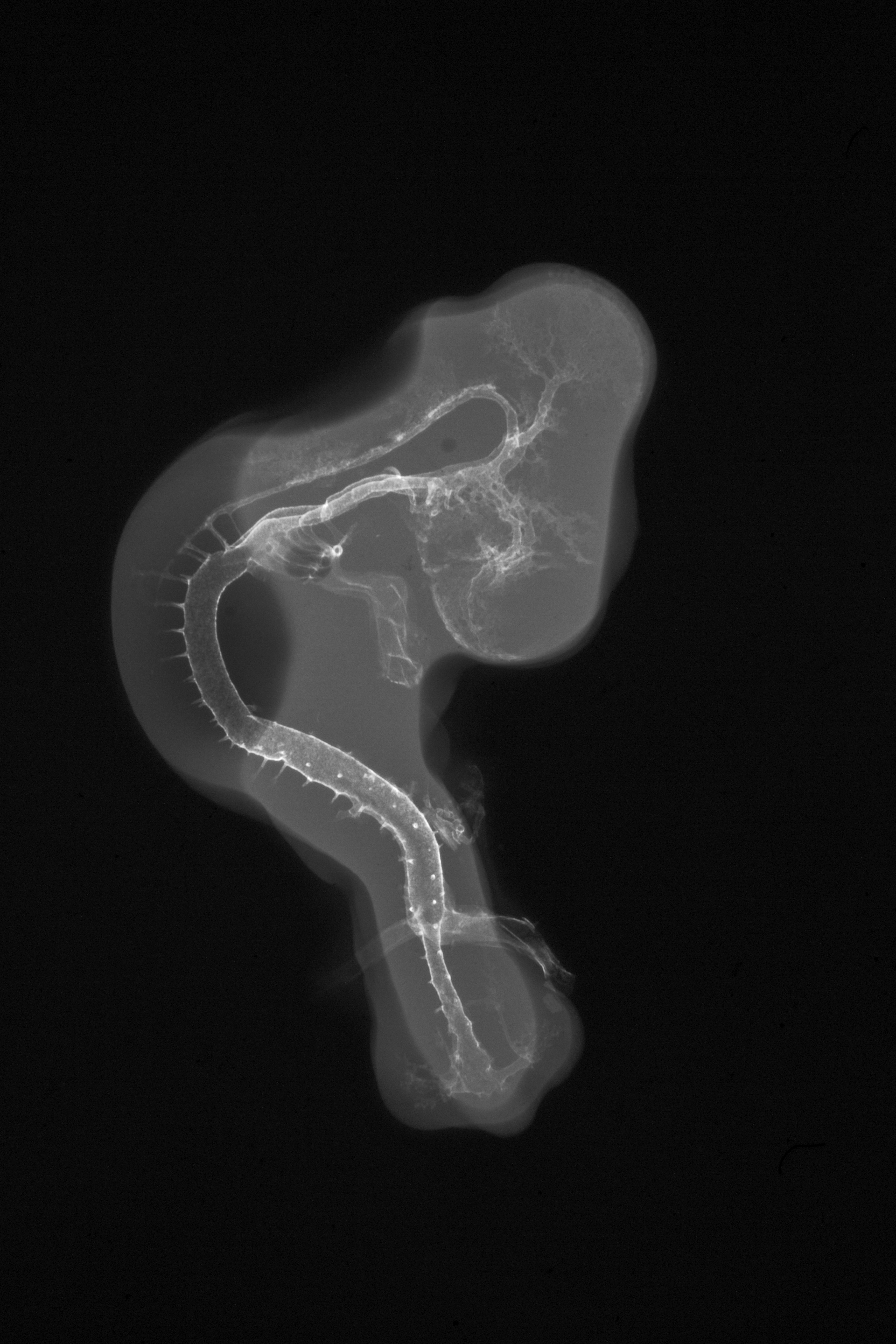 stage 20 chick embryo x-ray