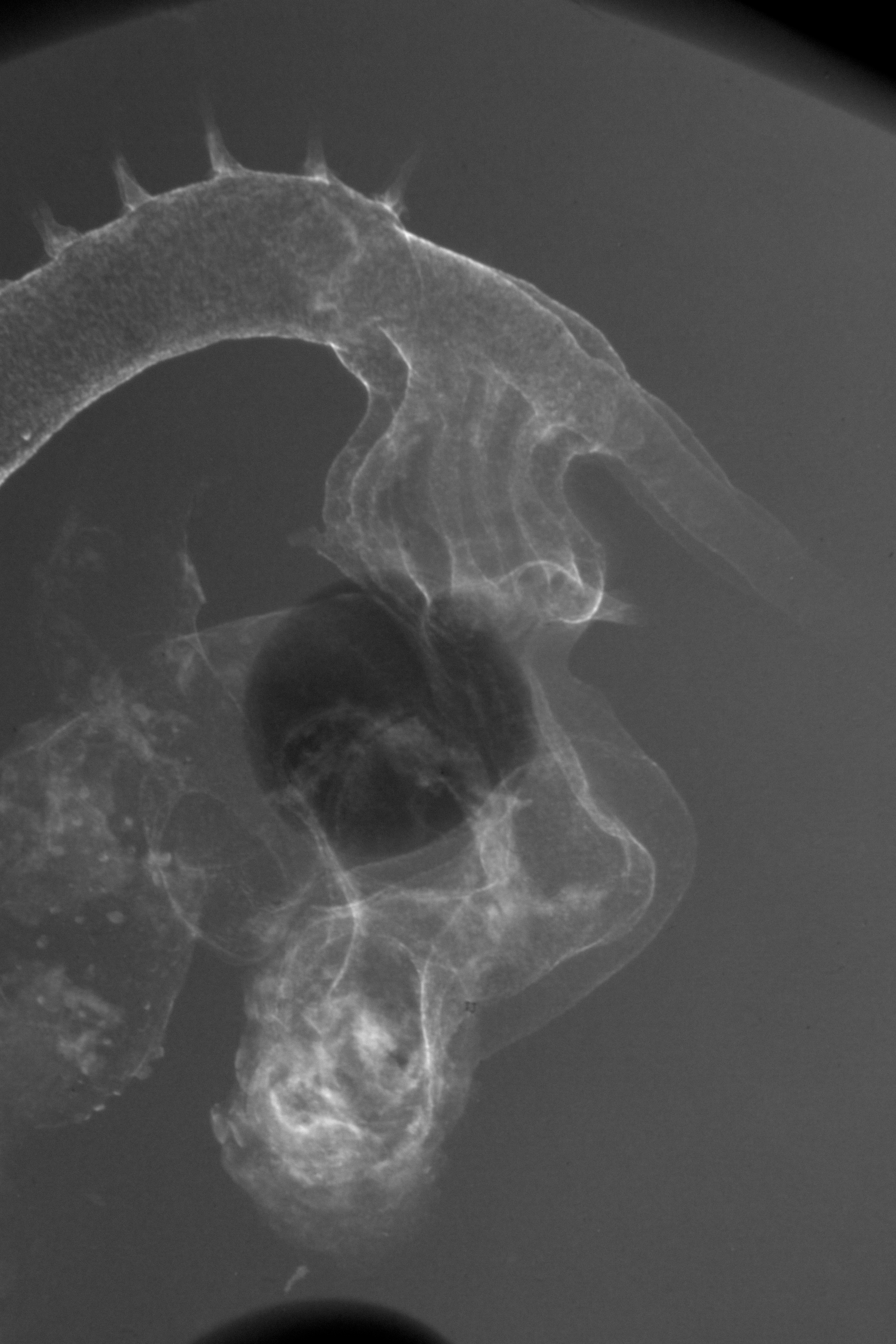 stage 21 chick embryo x-ray