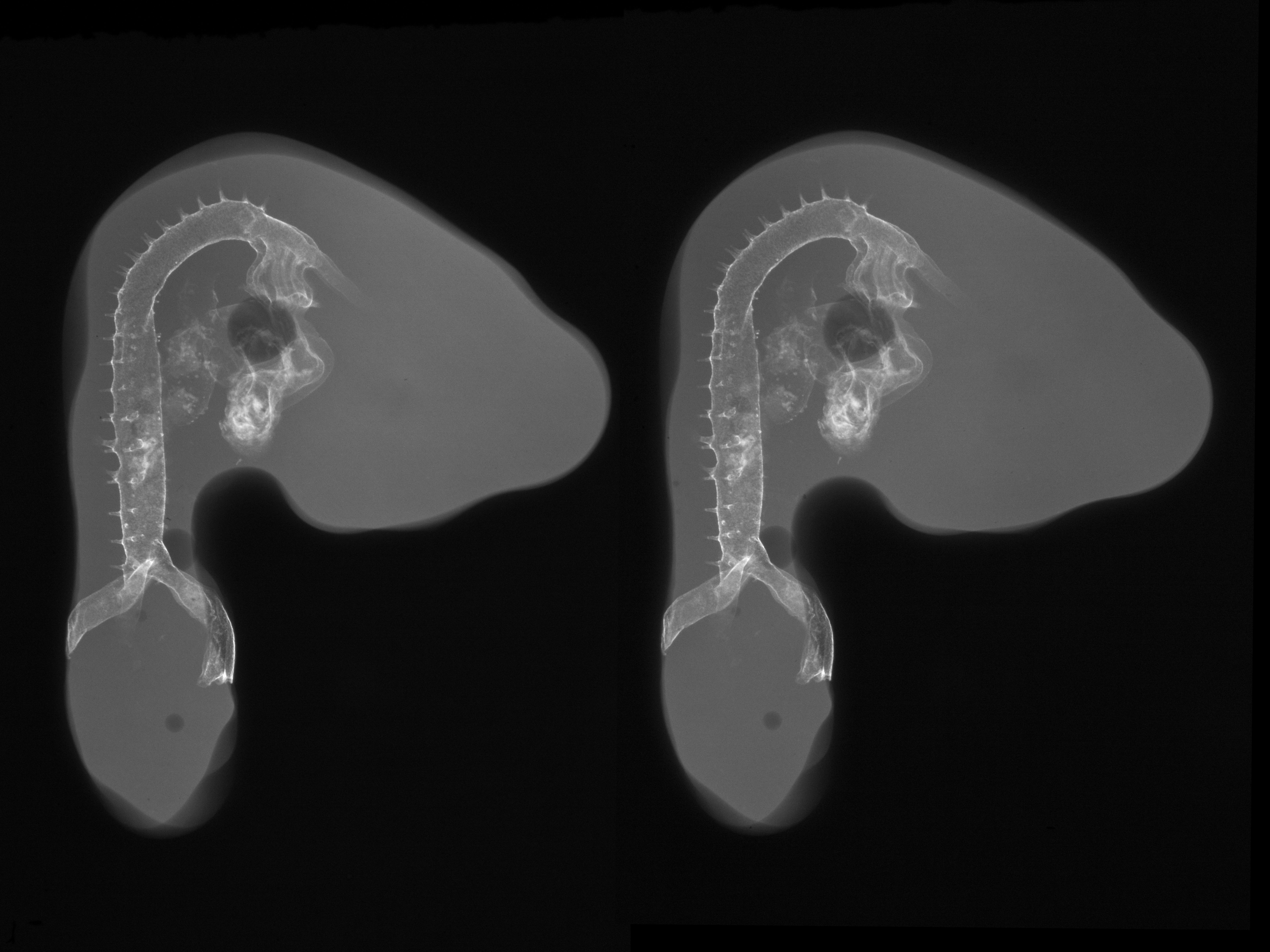 stage 21 chick embryo x-ray