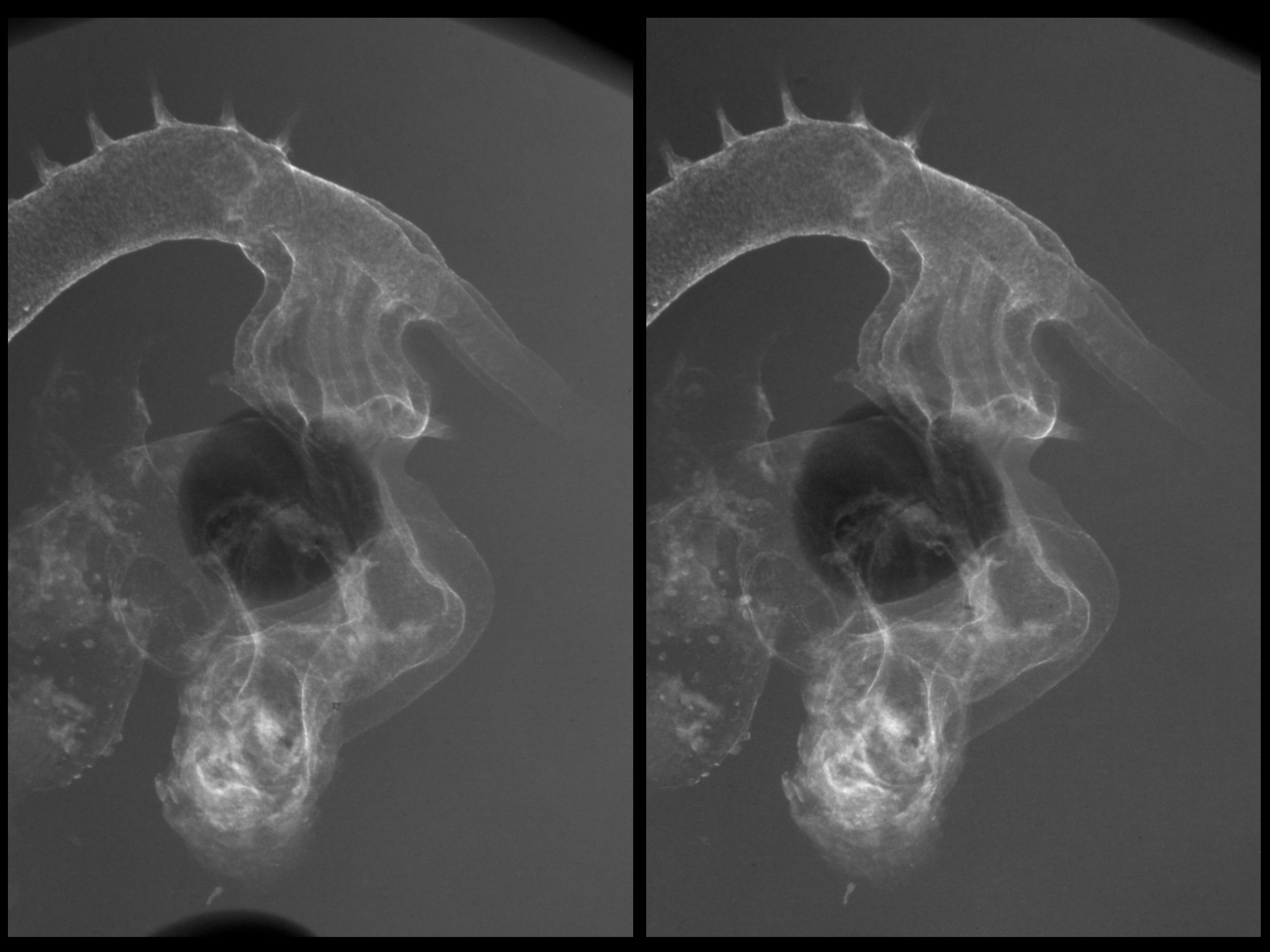 stage 21 chick embryo x-ray