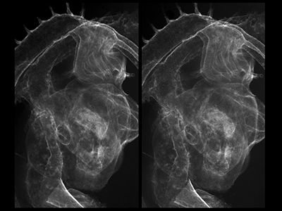 stage 22 chick embryo x-ray