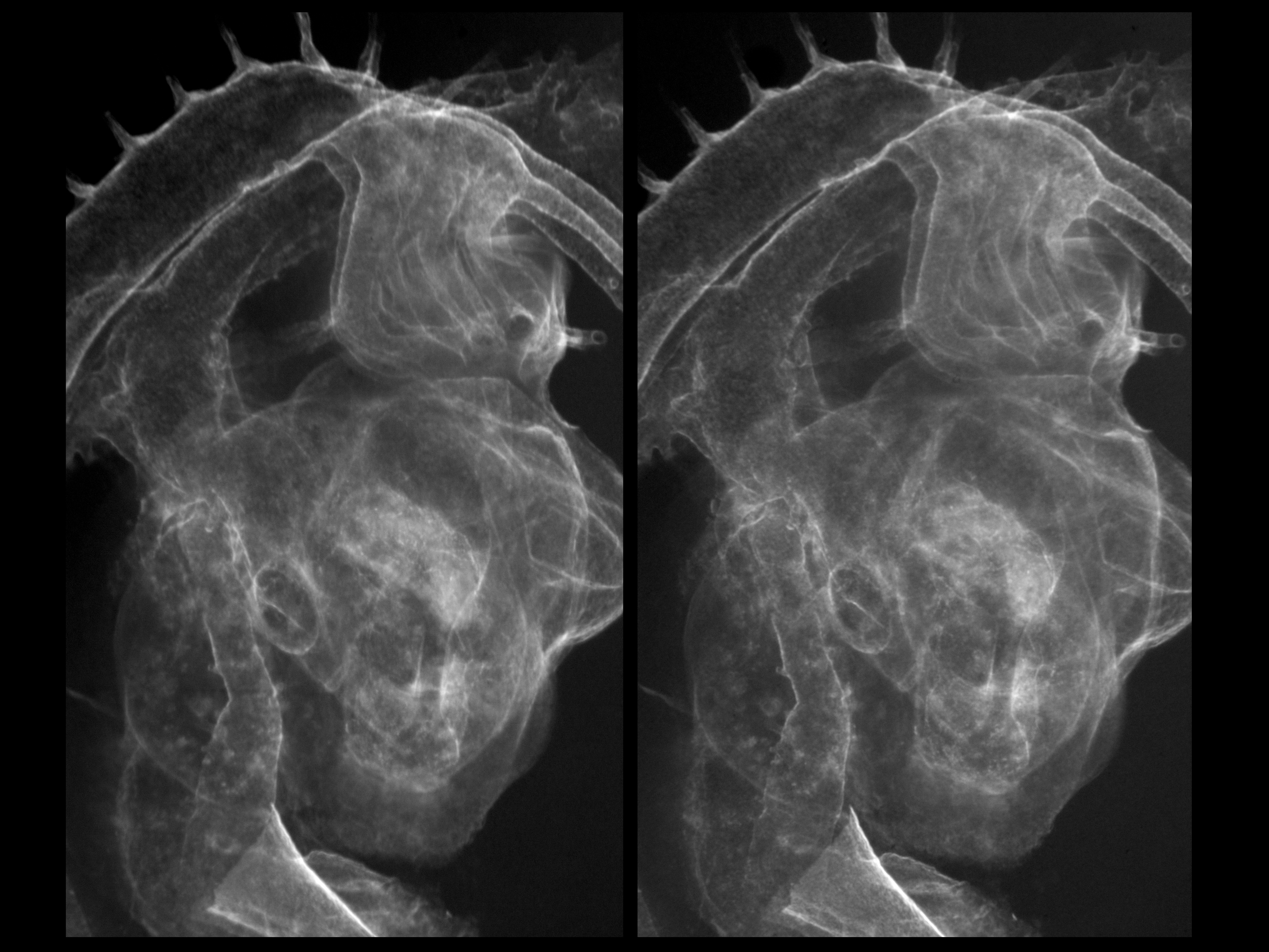 stage 22 chick embryo x-ray