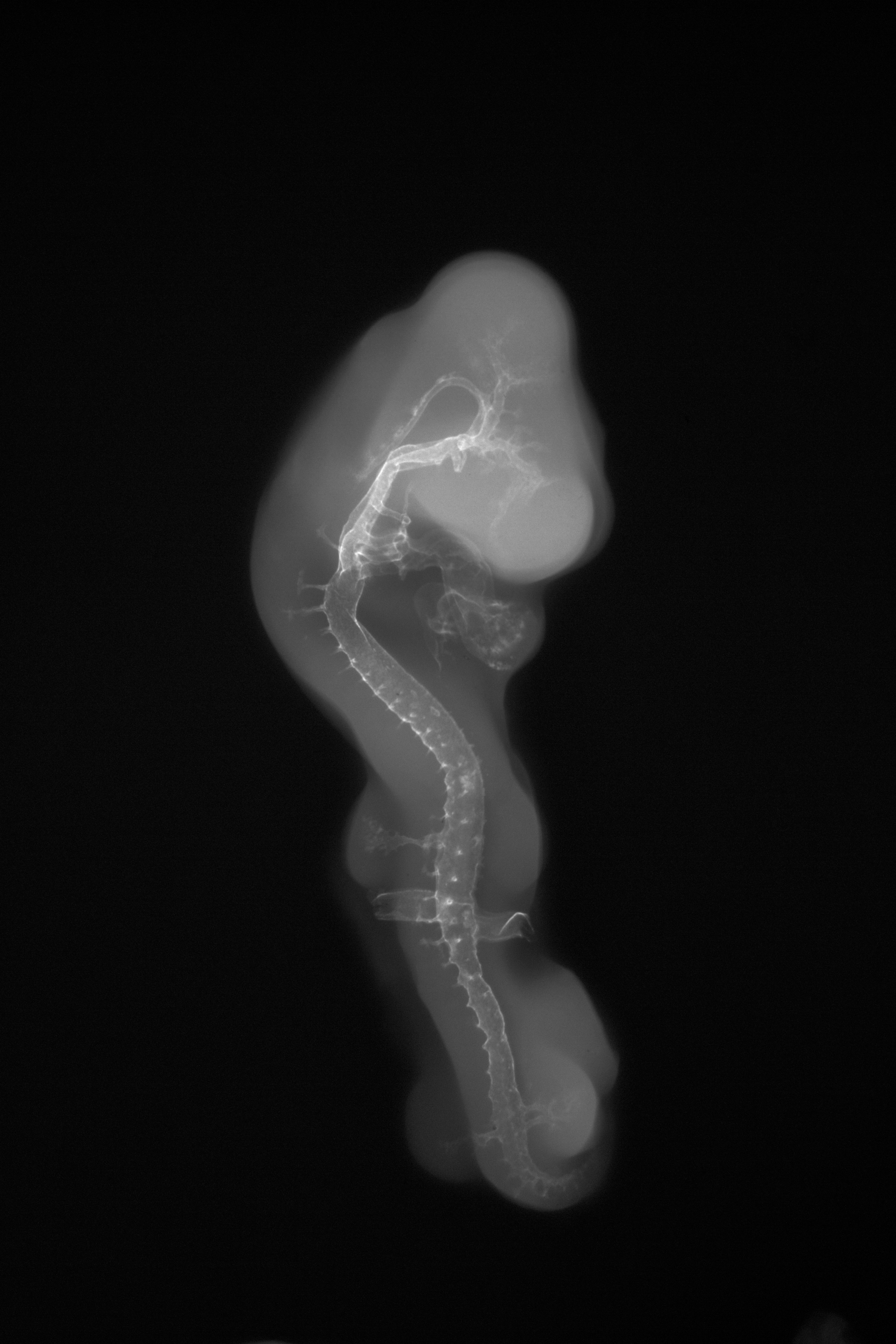 stage 22 chick embryo x-ray