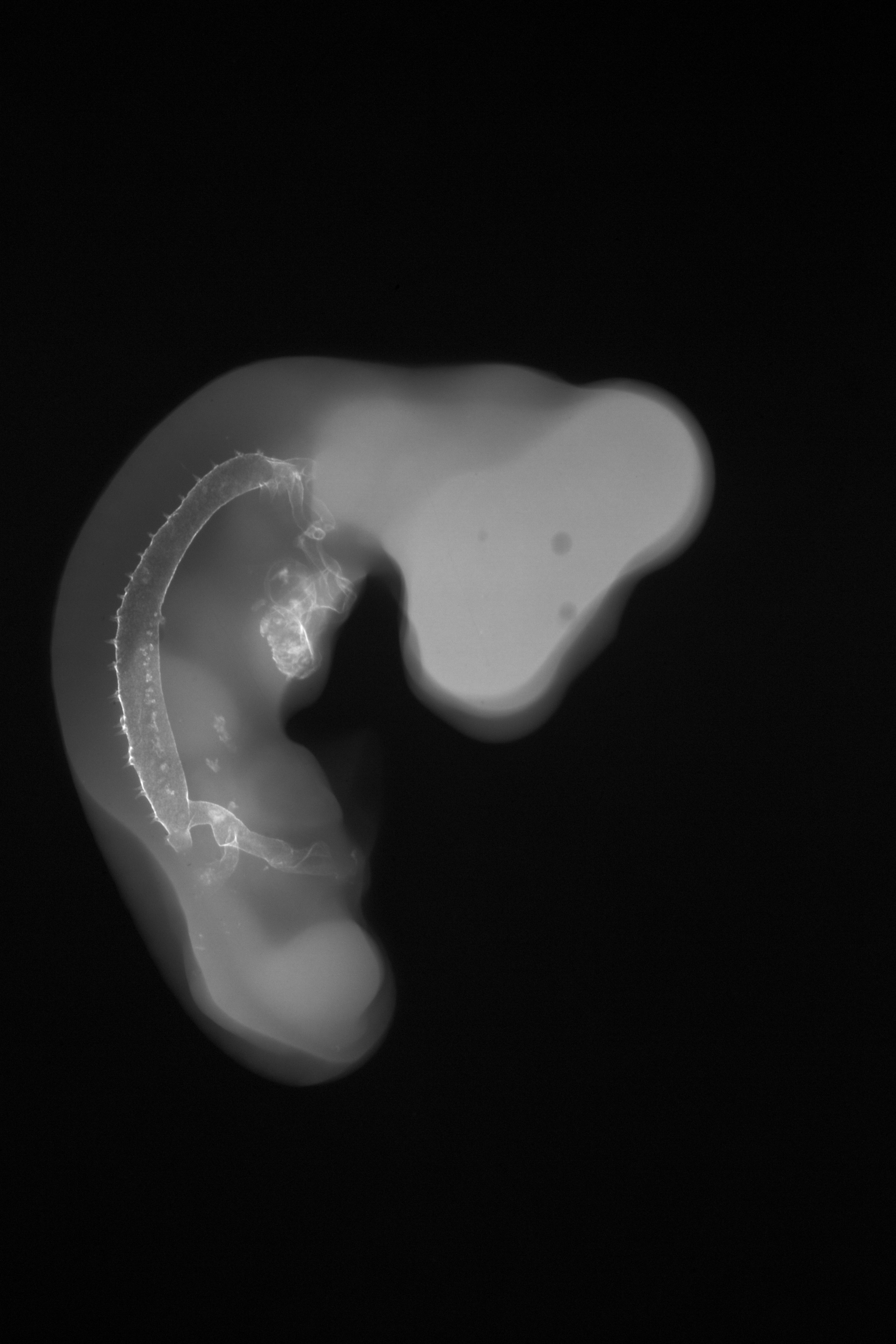 stage 22 chick embryo x-ray