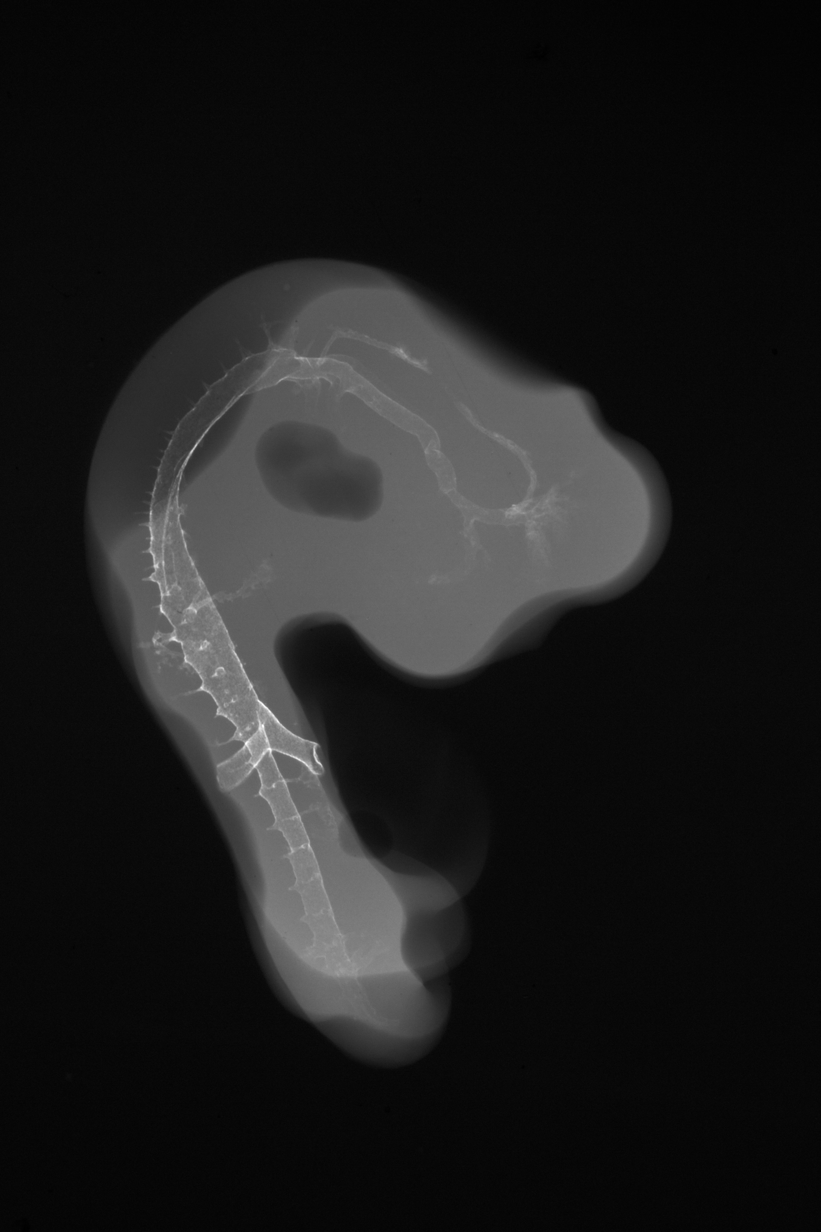 stage 23 chick embryo x-ray