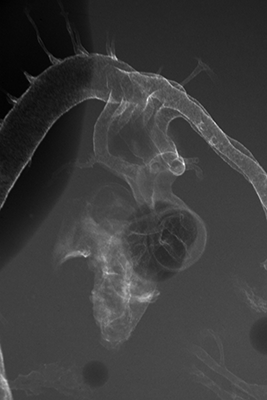 stage 23 chick embryo x-ray