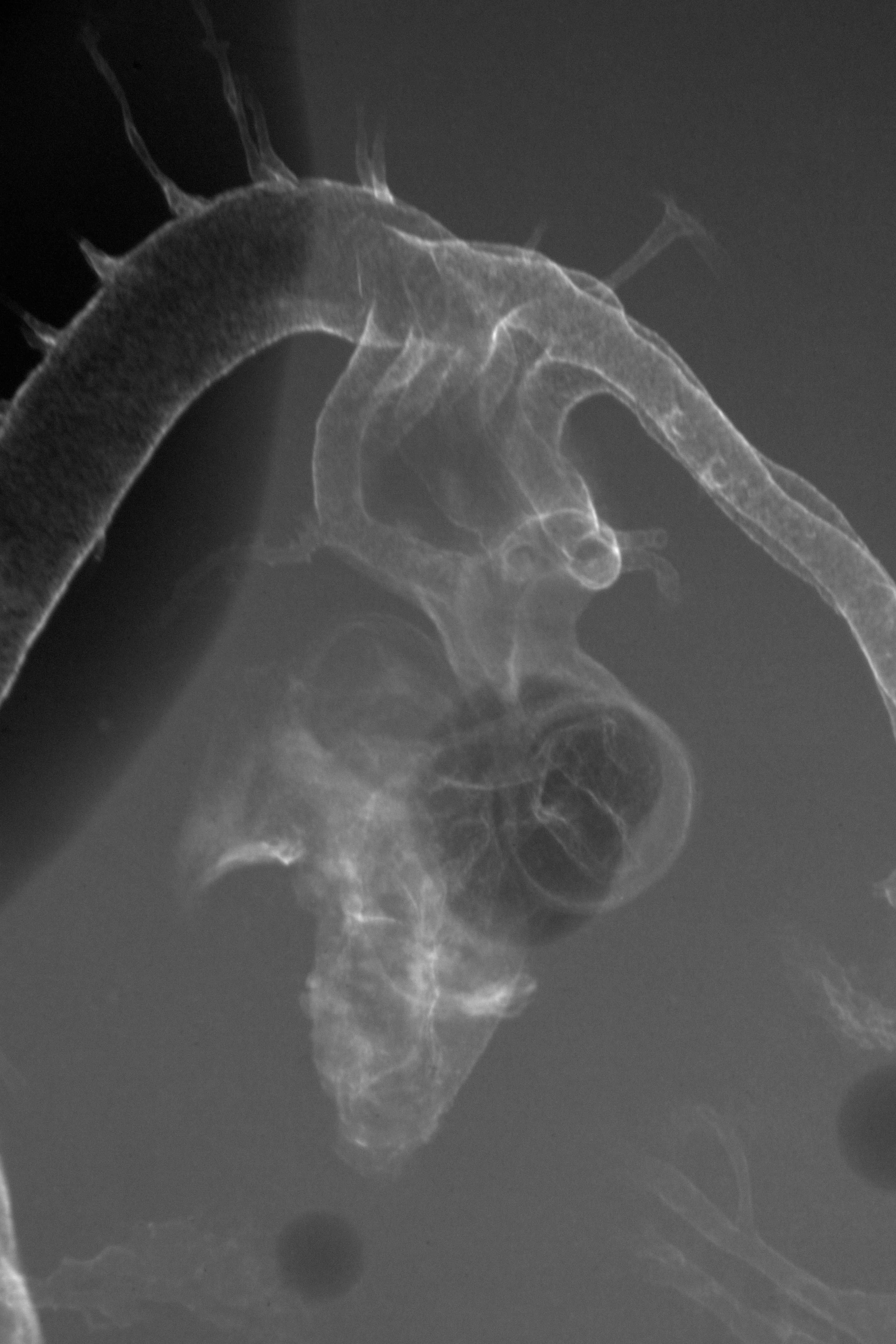 stage 23 chick embryo x-ray