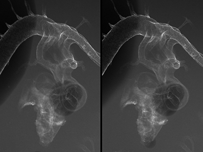 stage 23 chick embryo x-ray