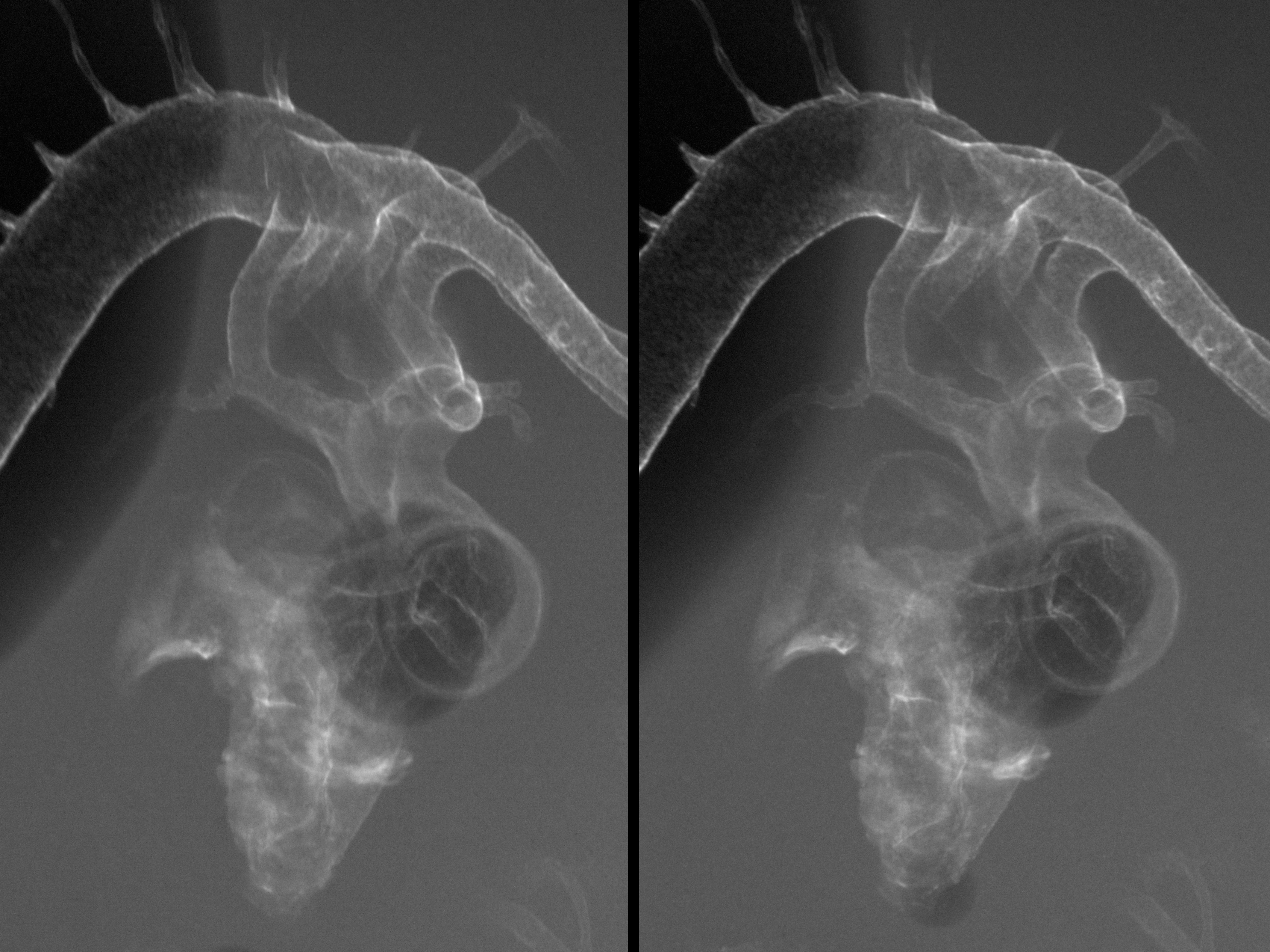 stage 23 chick embryo x-ray