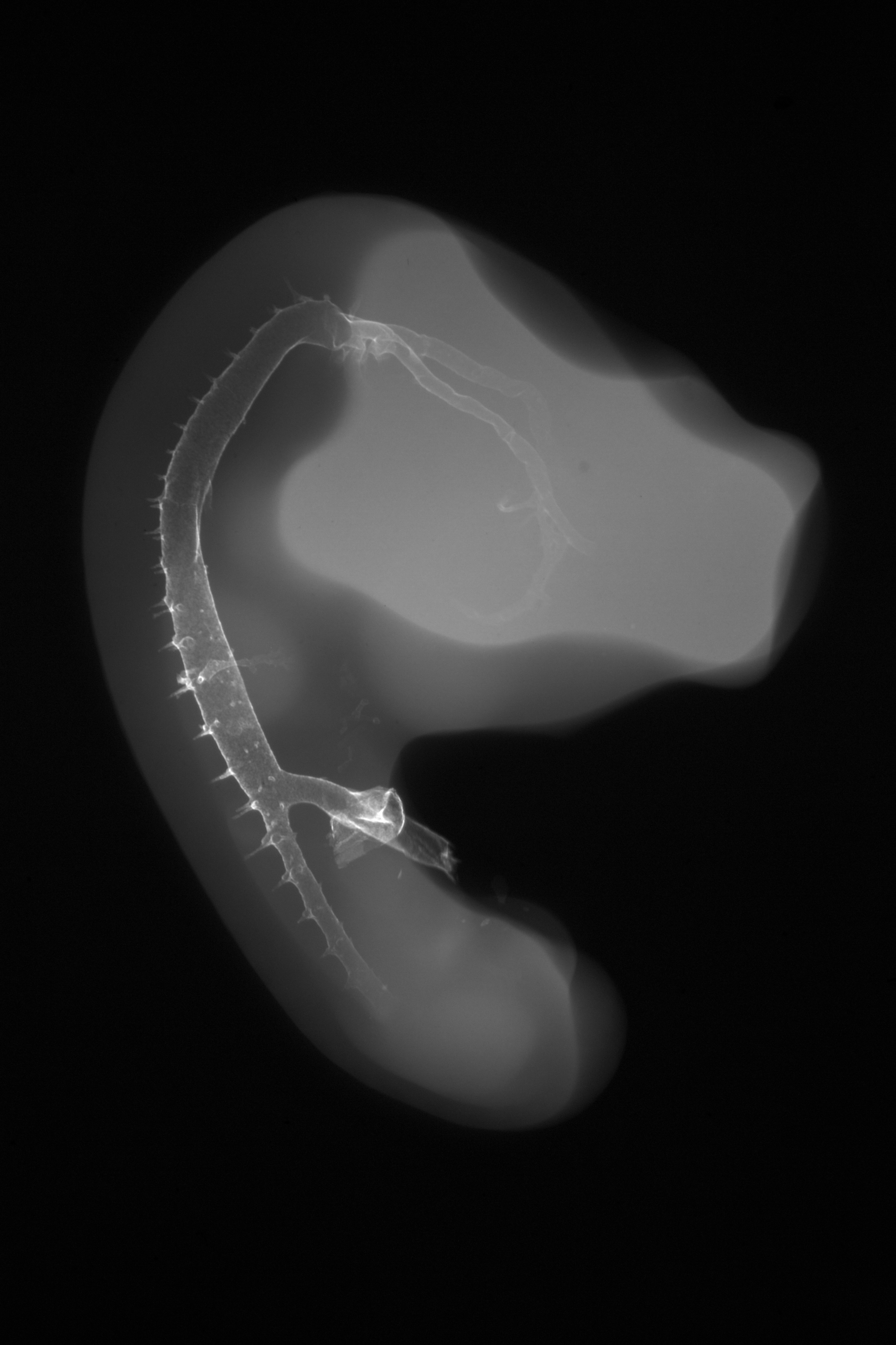 stage 23 chick embryo x-ray