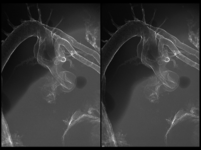 stage 24 chick embryo x-ray