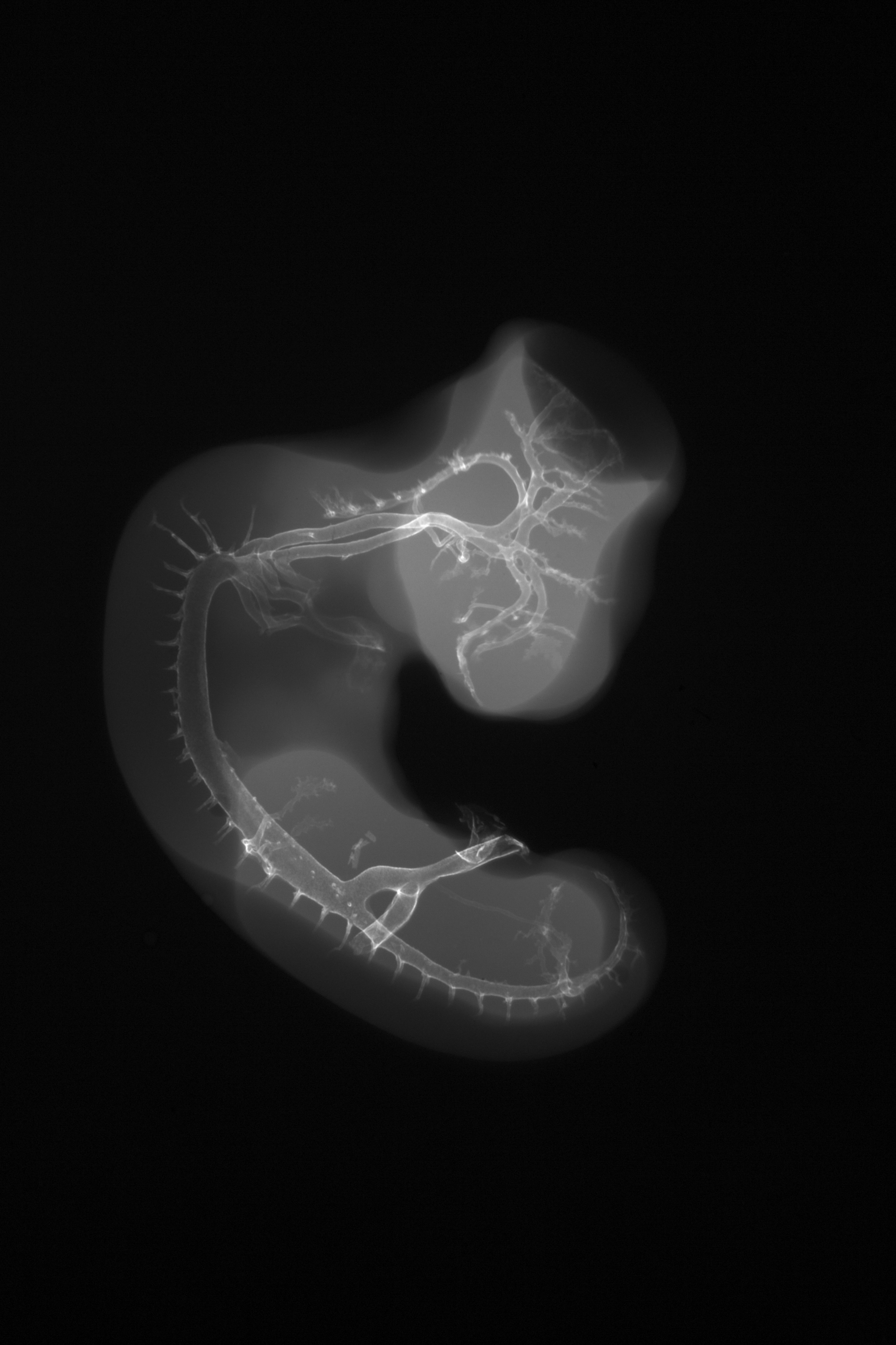 stage 24 chick embryo x-ray