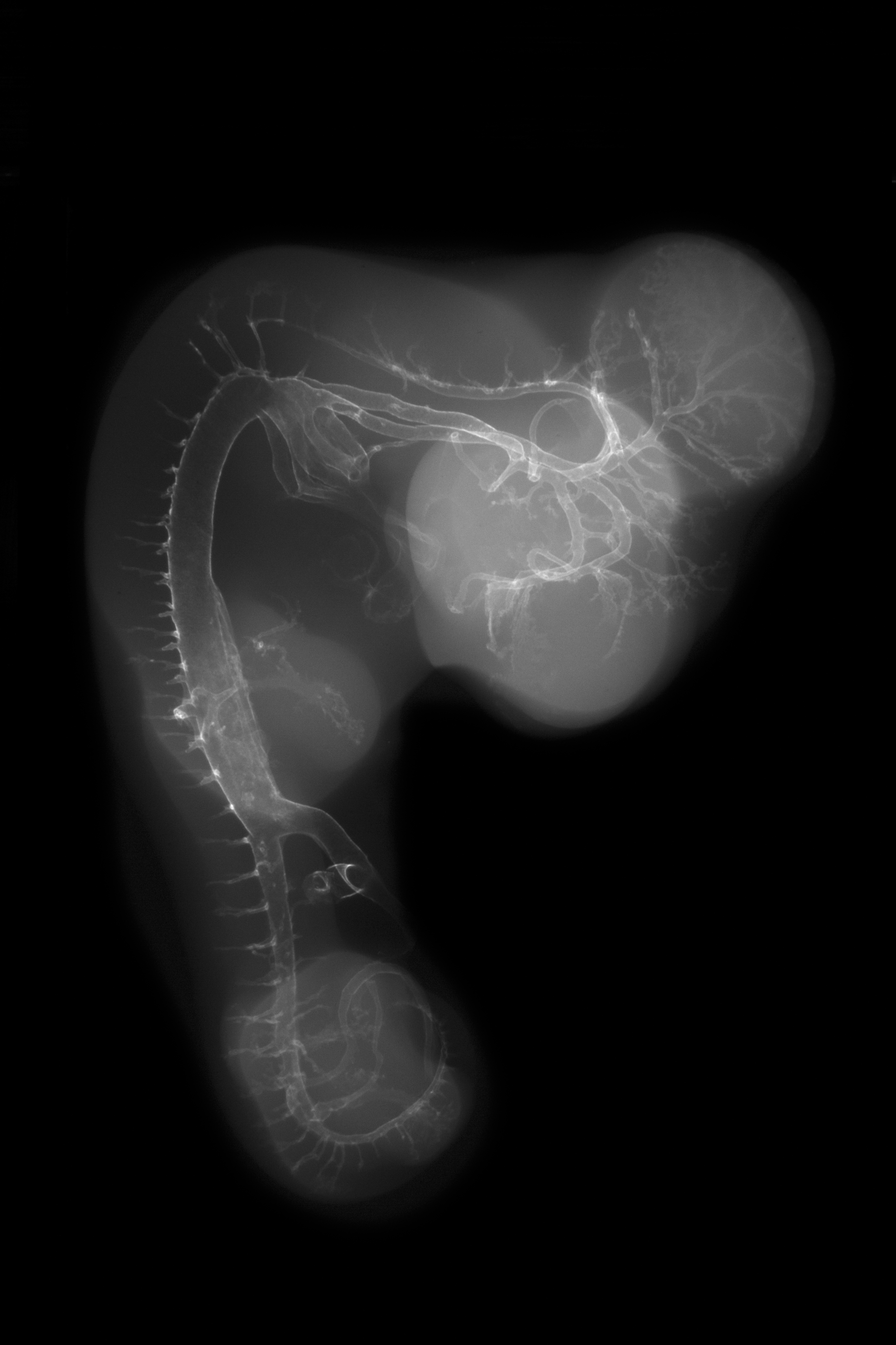 stage 25 chick embryo x-ray