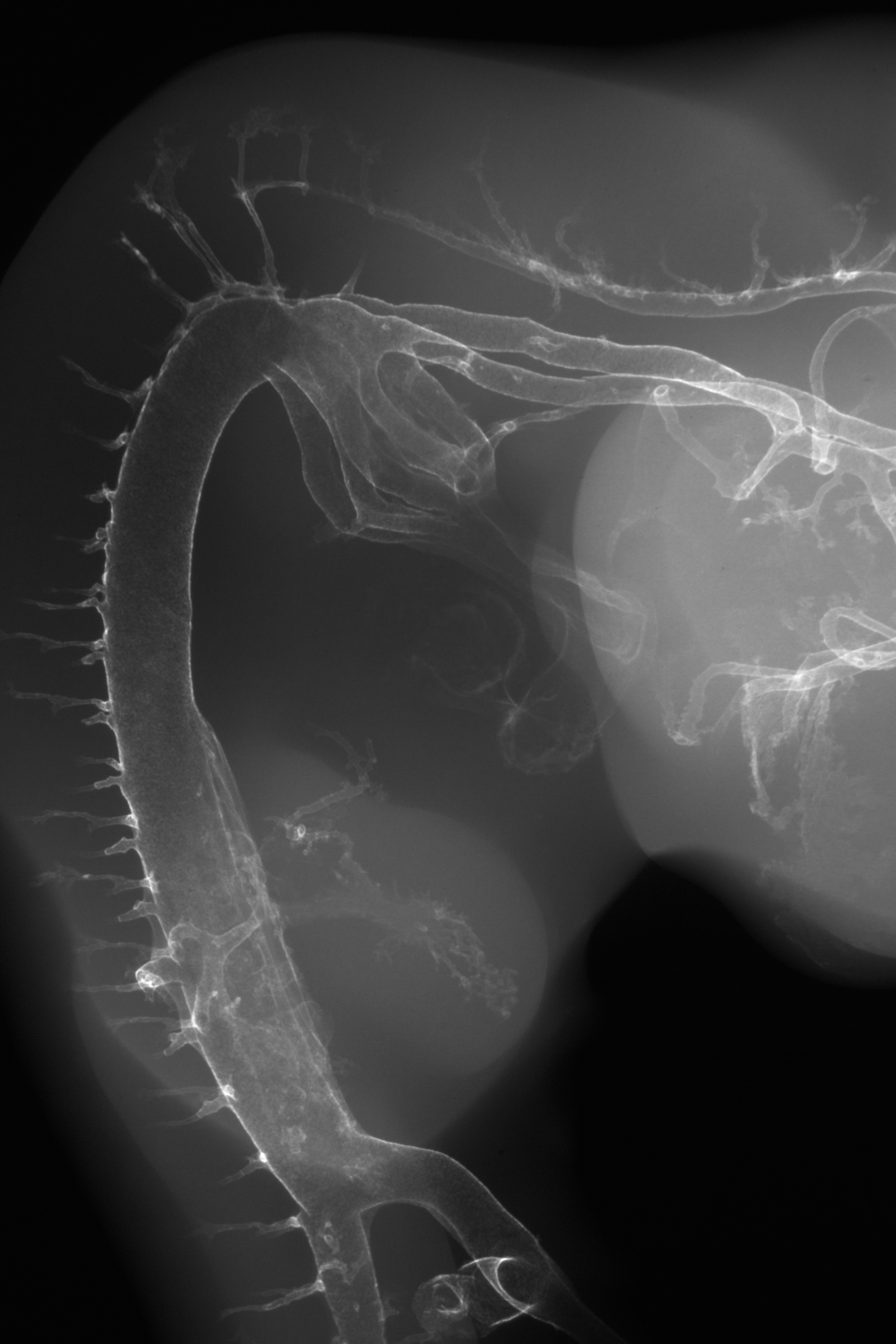 stage 25 chick embryo x-ray