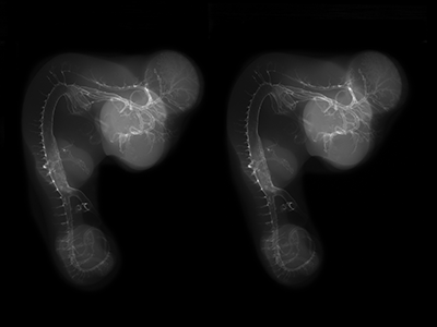 stage 25 chick embryo x-ray