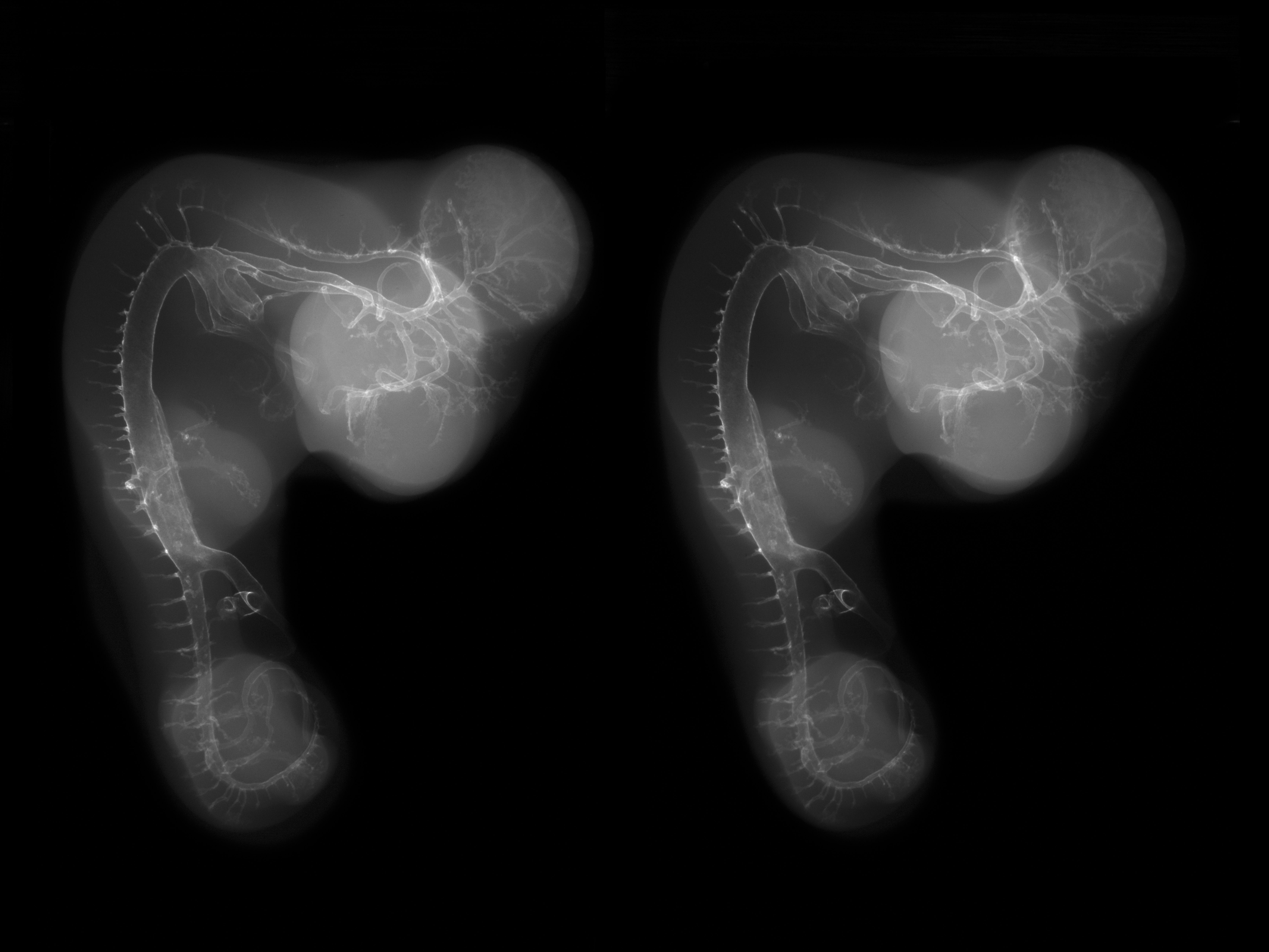 stage 25 chick embryo x-ray
