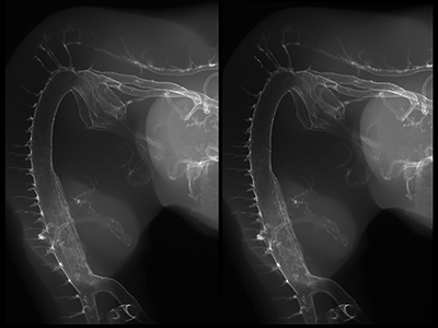 stage 25 chick embryo x-ray