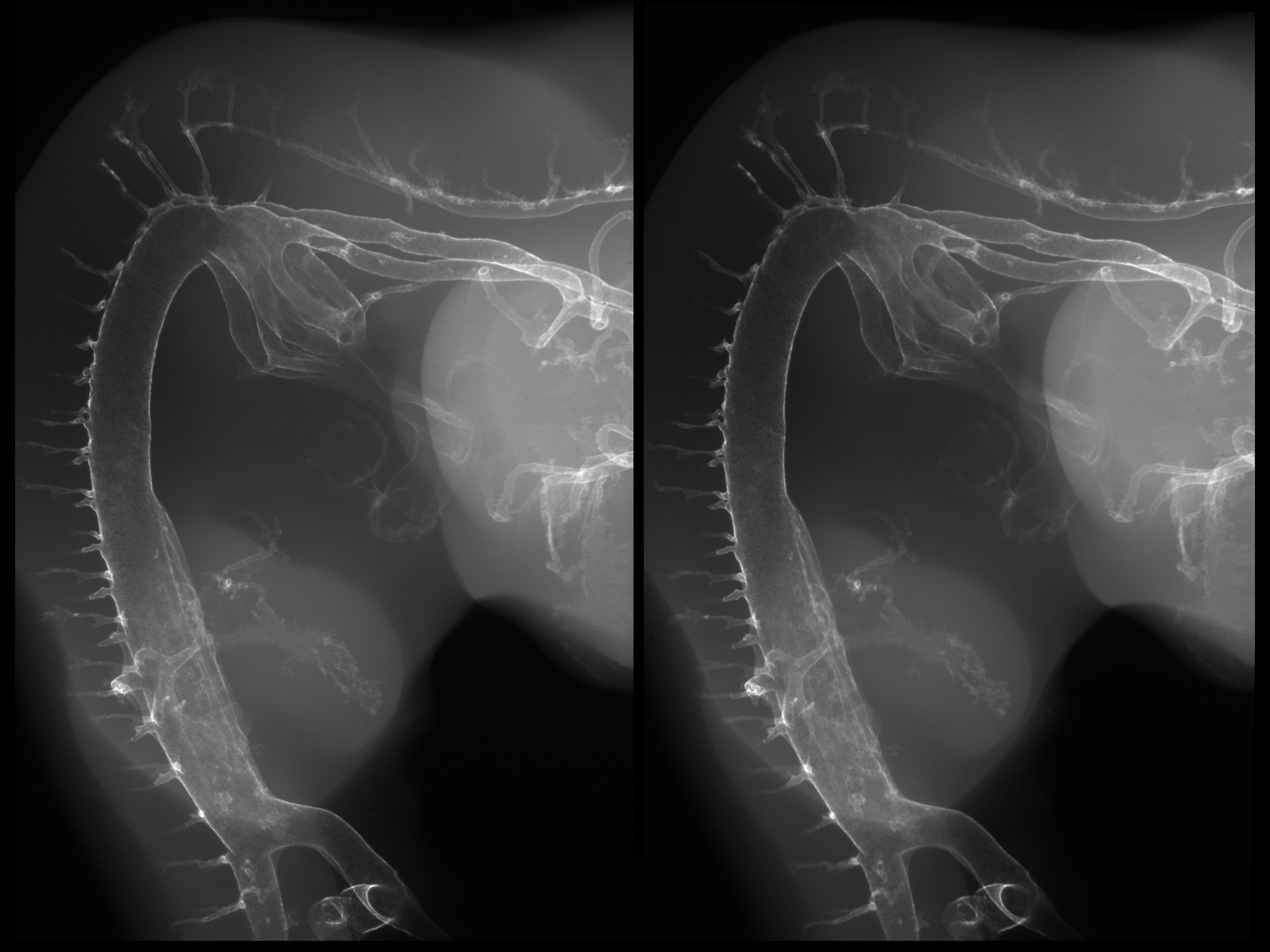stage 25 chick embryo x-ray