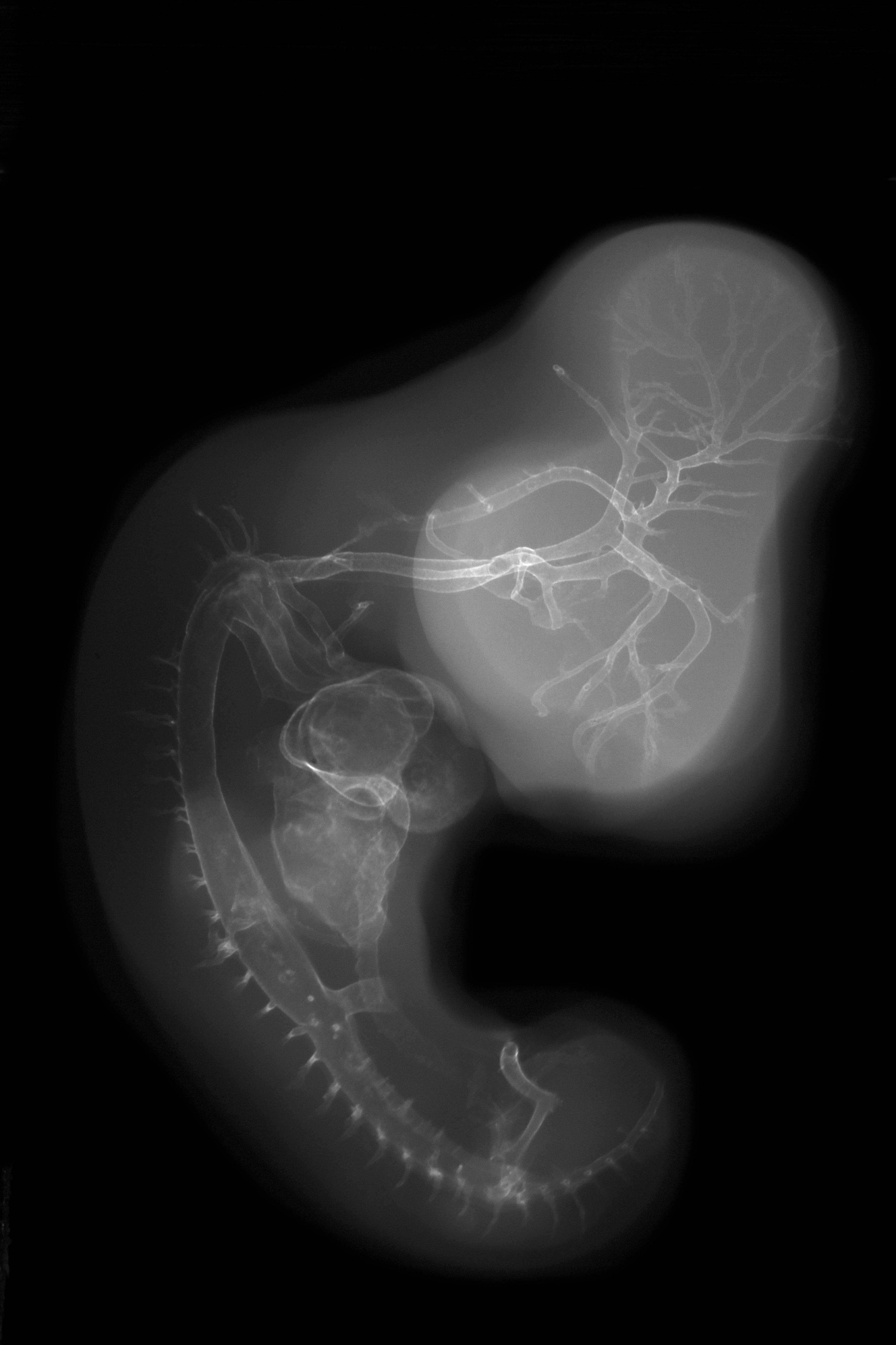 stage 26 chick embryo x-ray