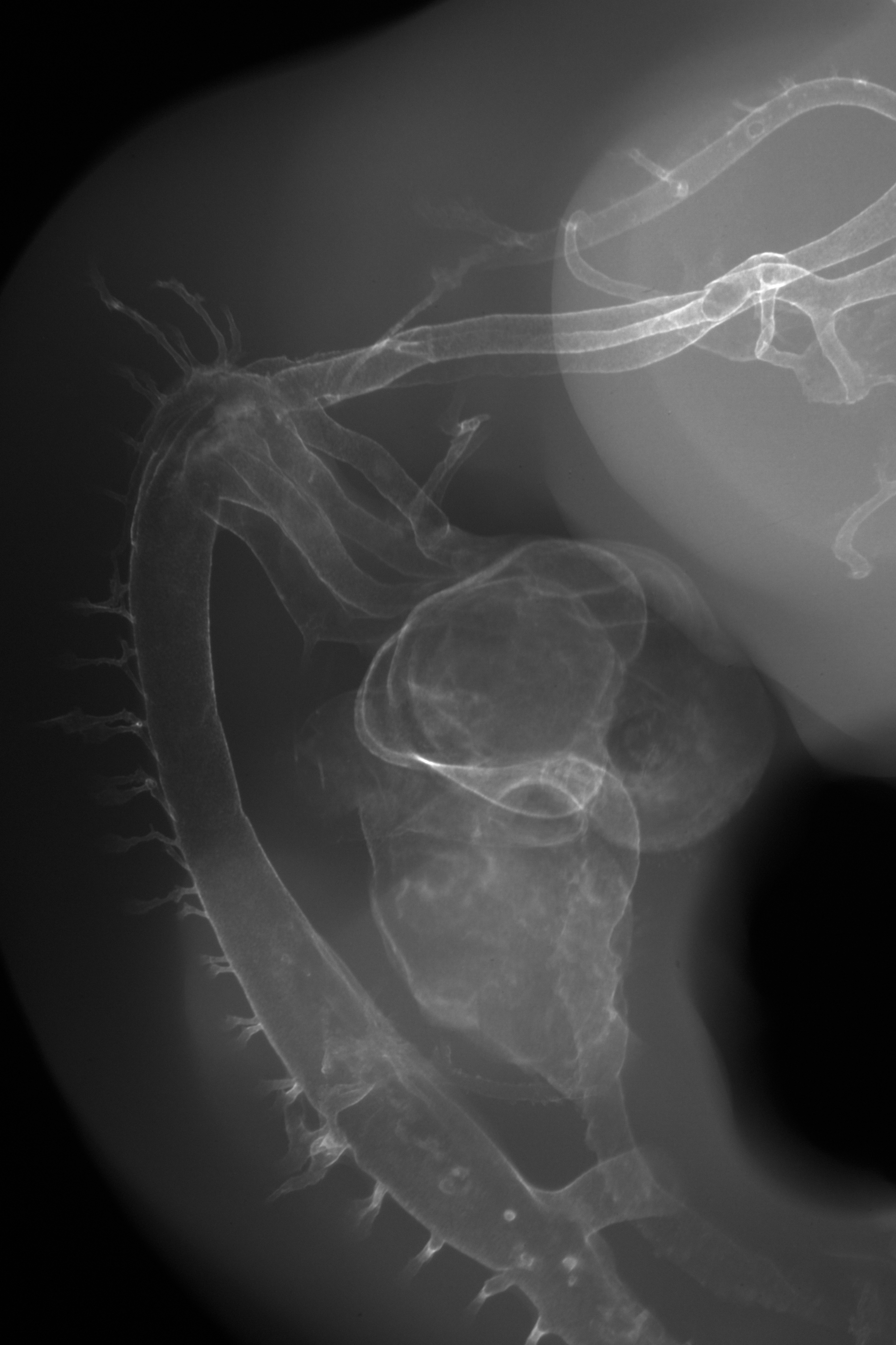 stage 26 chick embryo x-ray