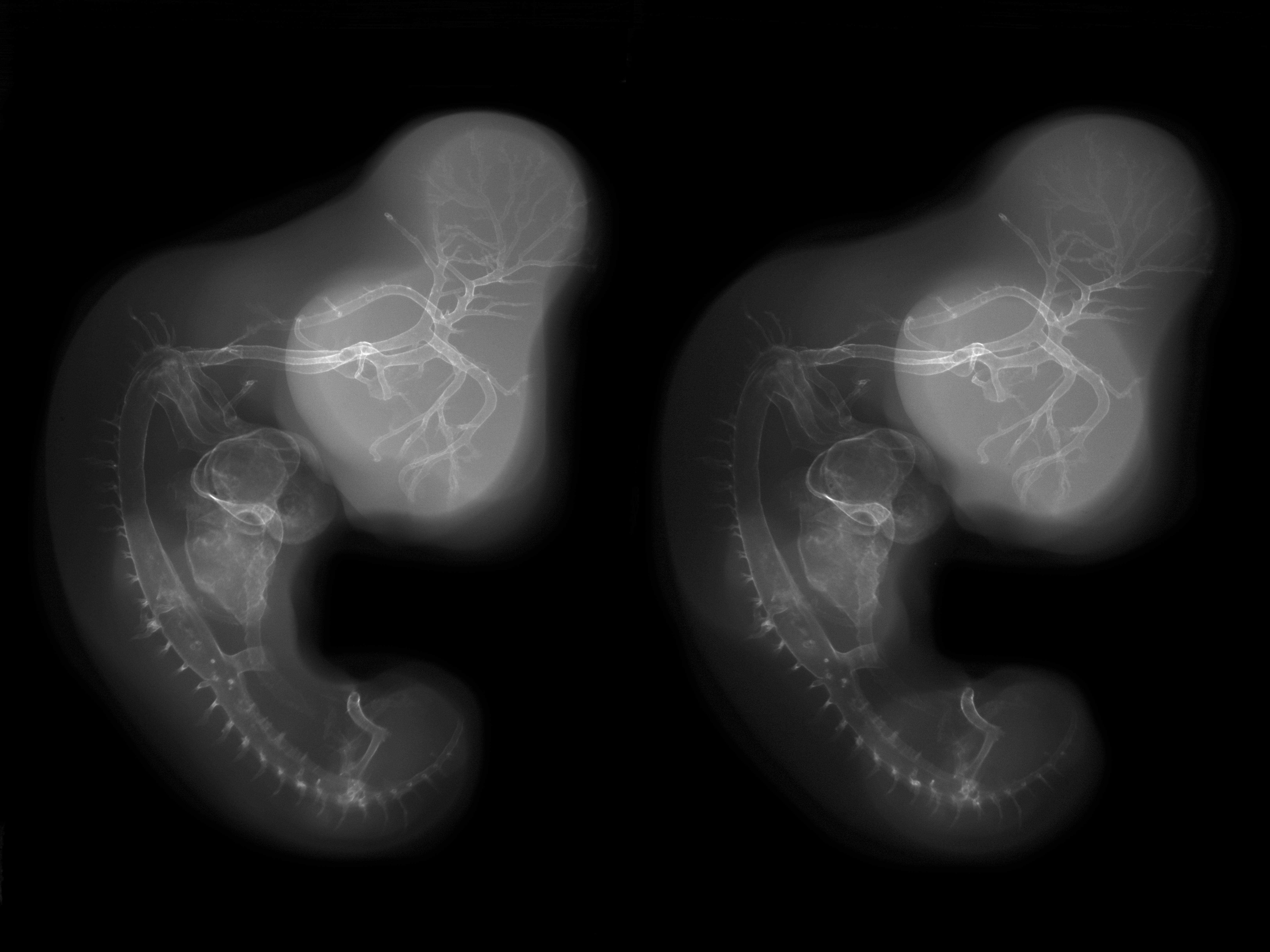 stage 26 chick embryo x-ray