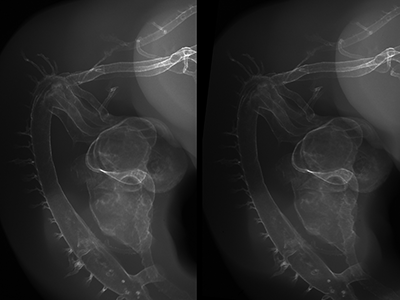 stage 26 chick embryo x-ray