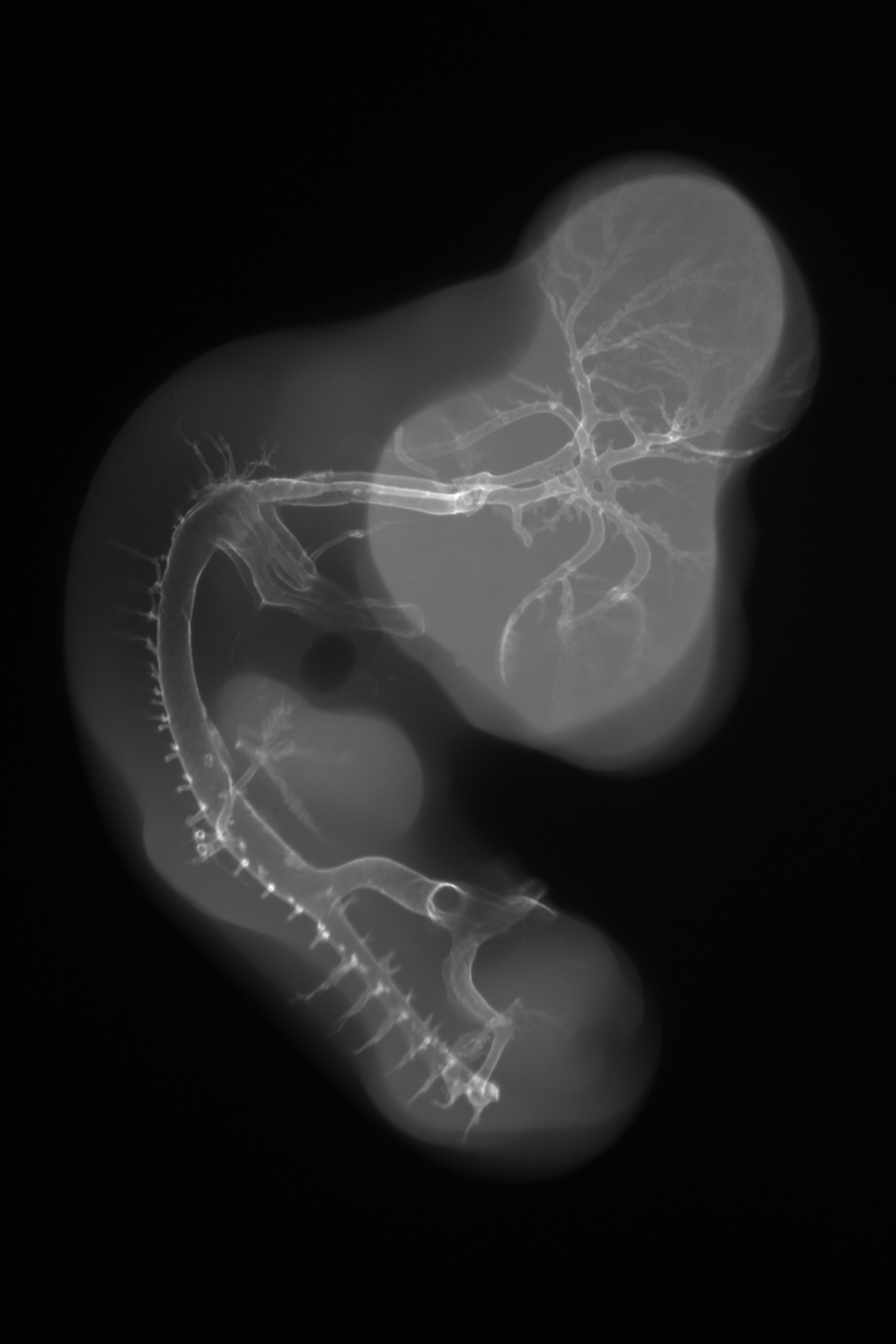 stage 26 chick embryo x-ray