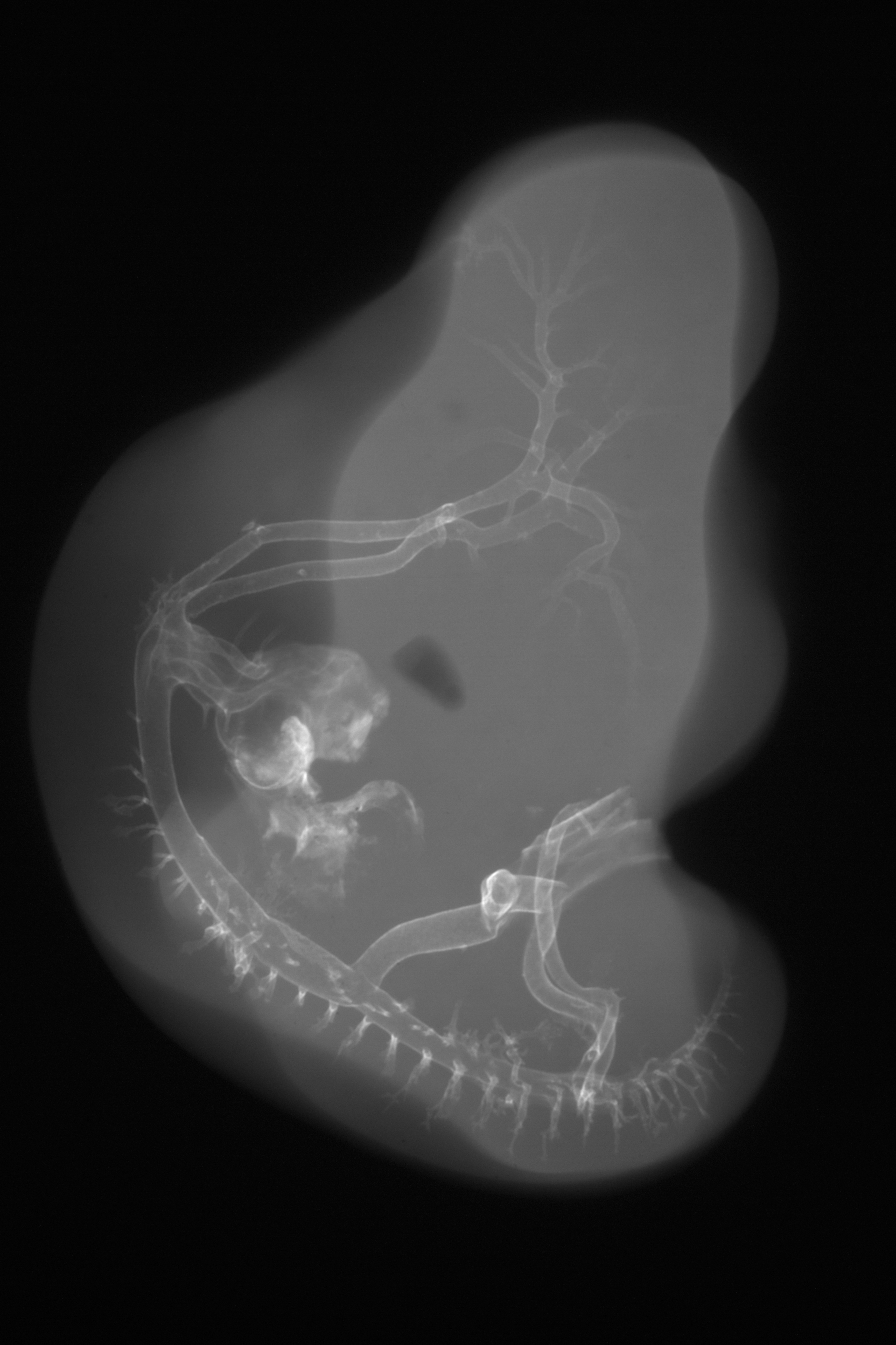 stage 26 chick embryo x-ray