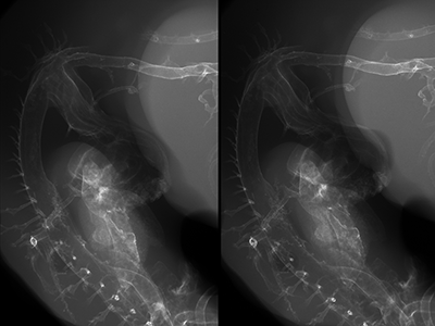 stage 27 chick embryo x-ray