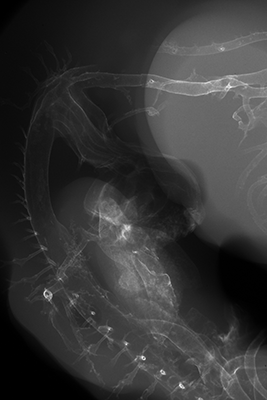 stage 27 chick embryo x-ray